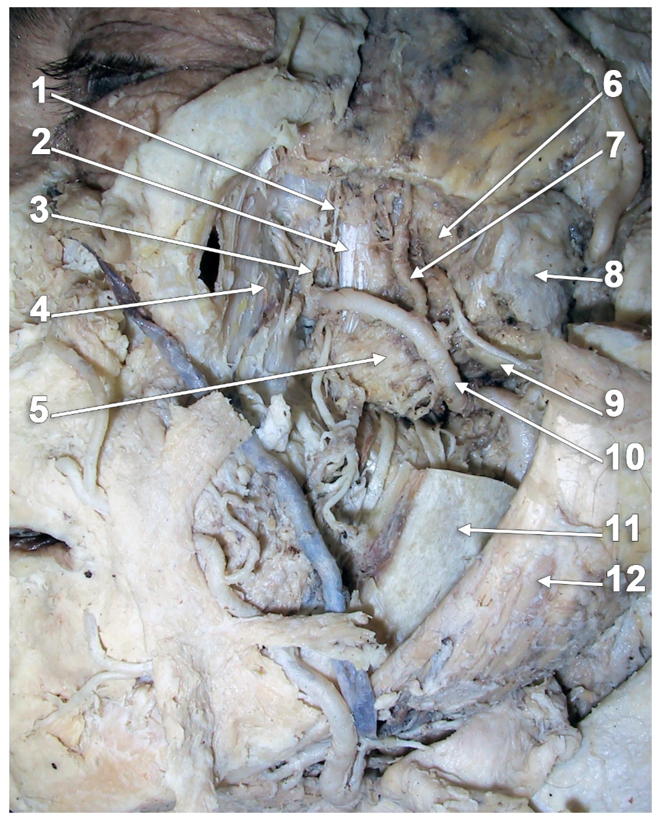 Medicina 60 01913 g016
