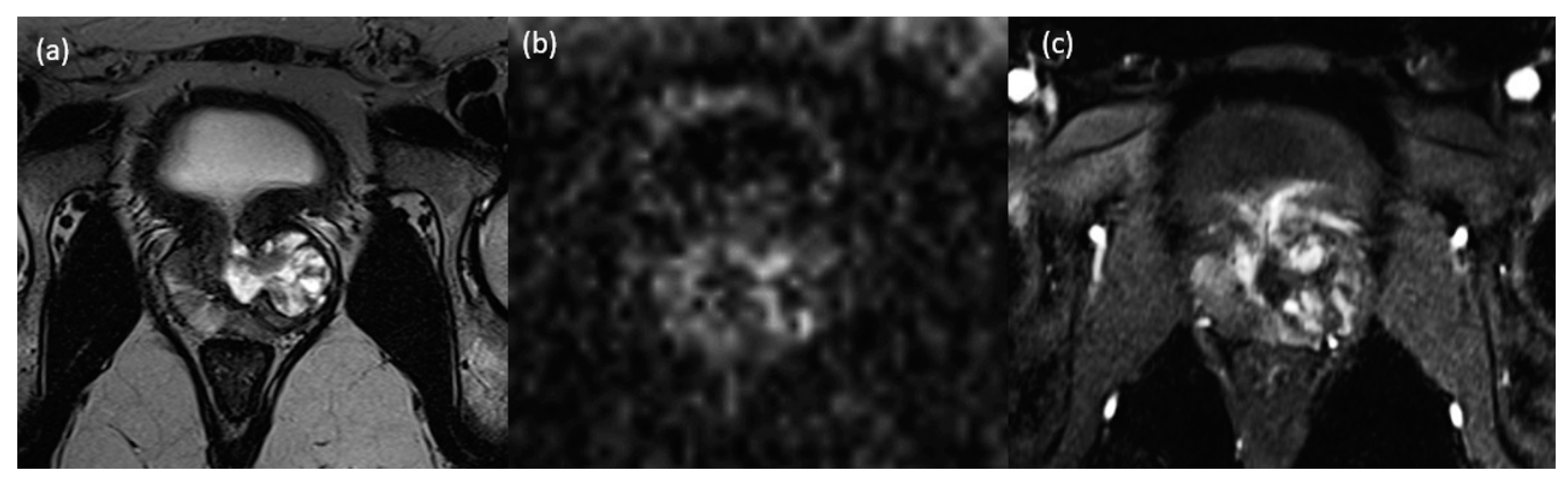 Medicina 60 01918 g001