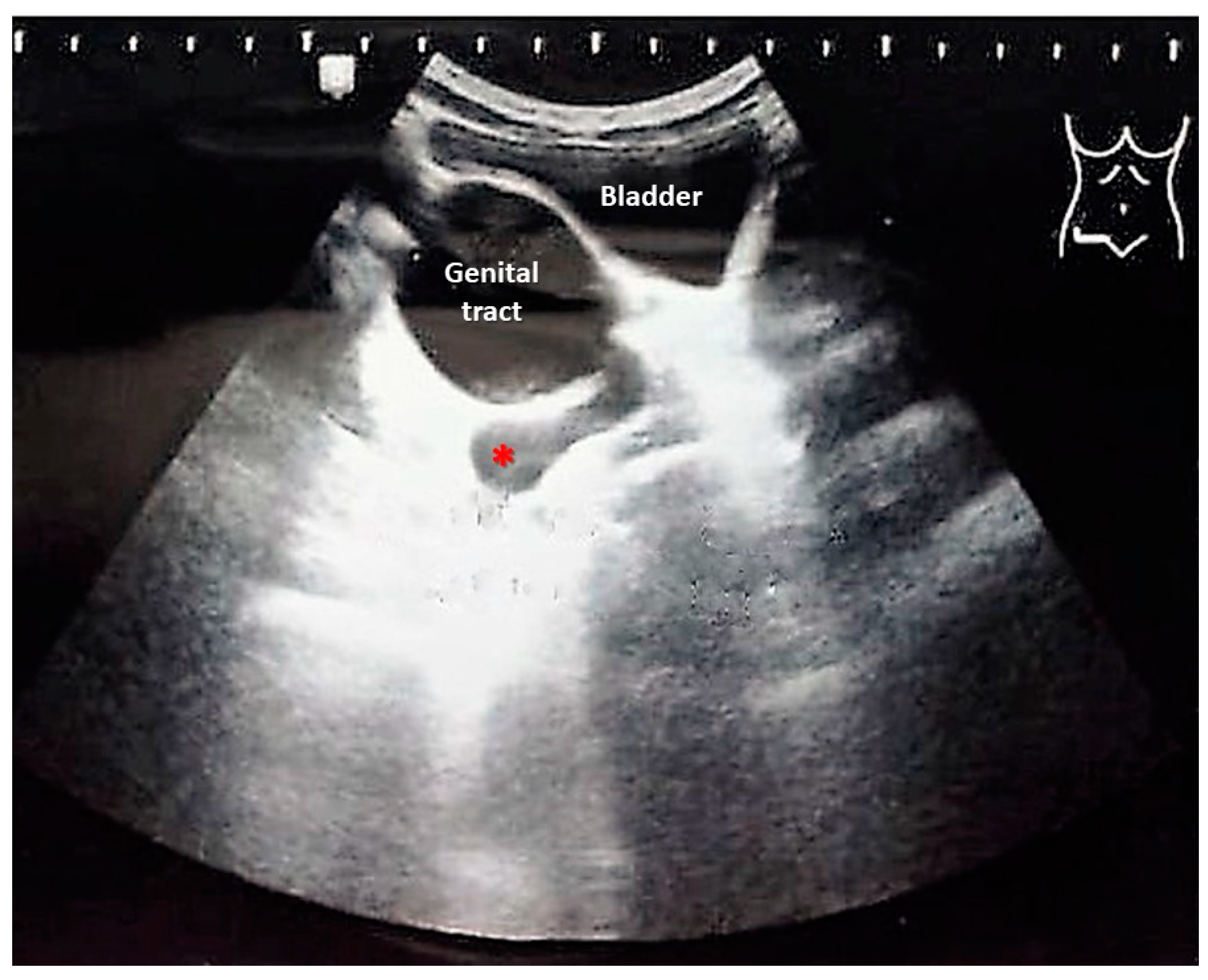 Medicina 60 01922 g001