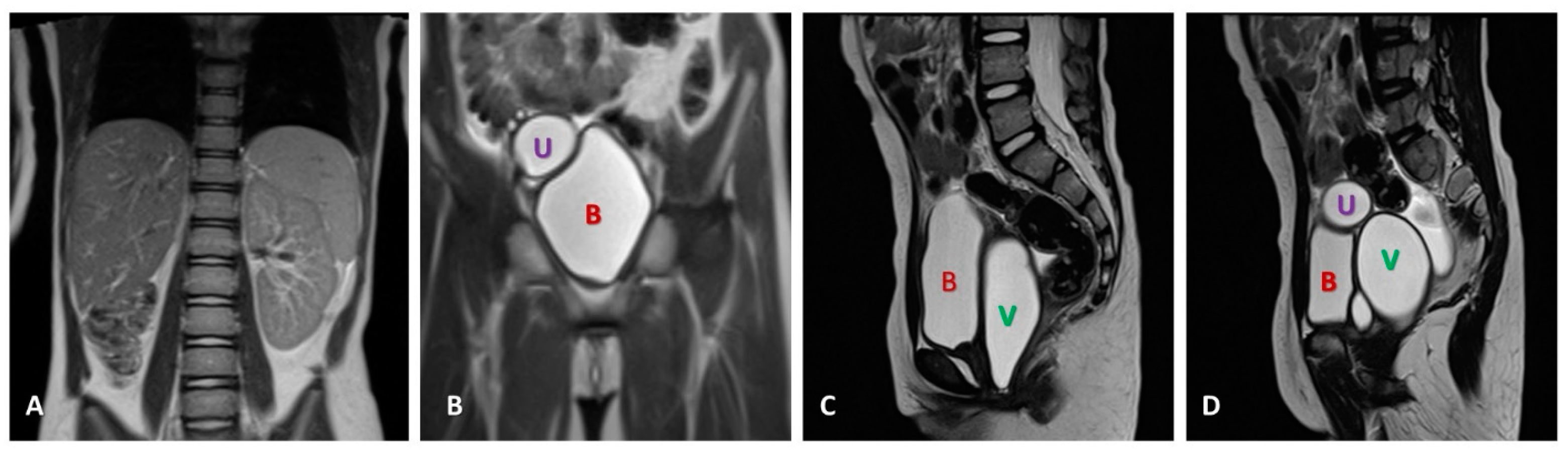 Medicina 60 01922 g003