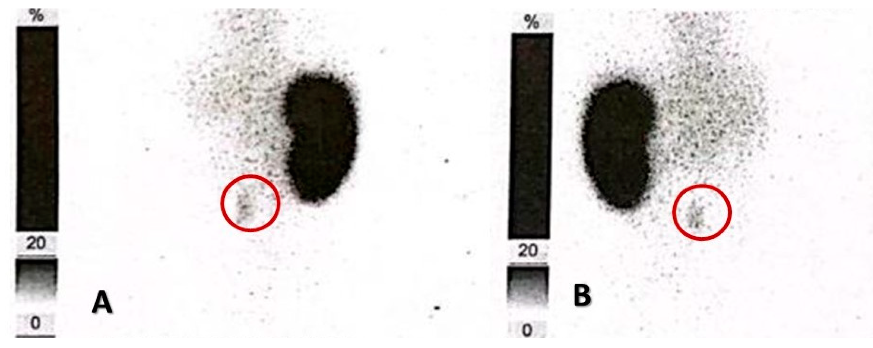 Medicina 60 01922 g005