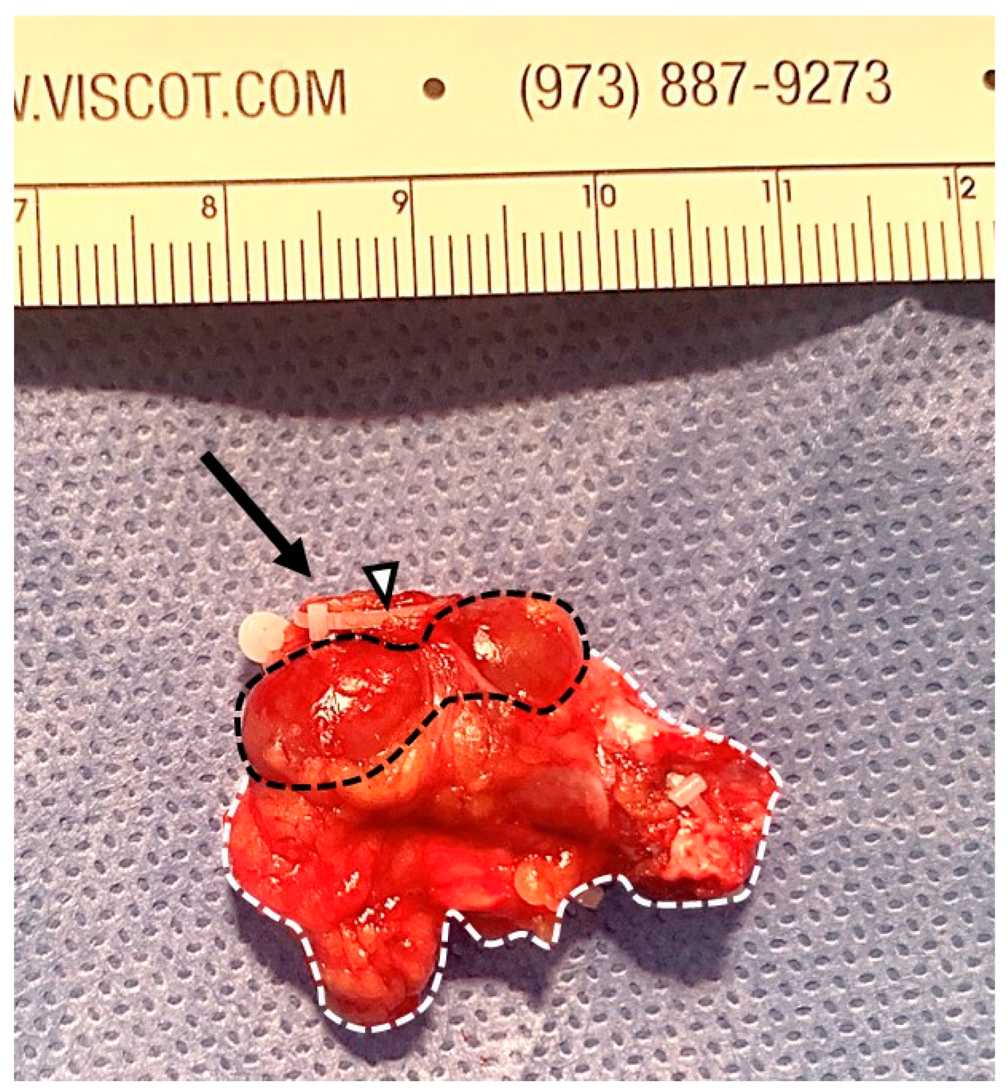 Medicina 60 01922 g006