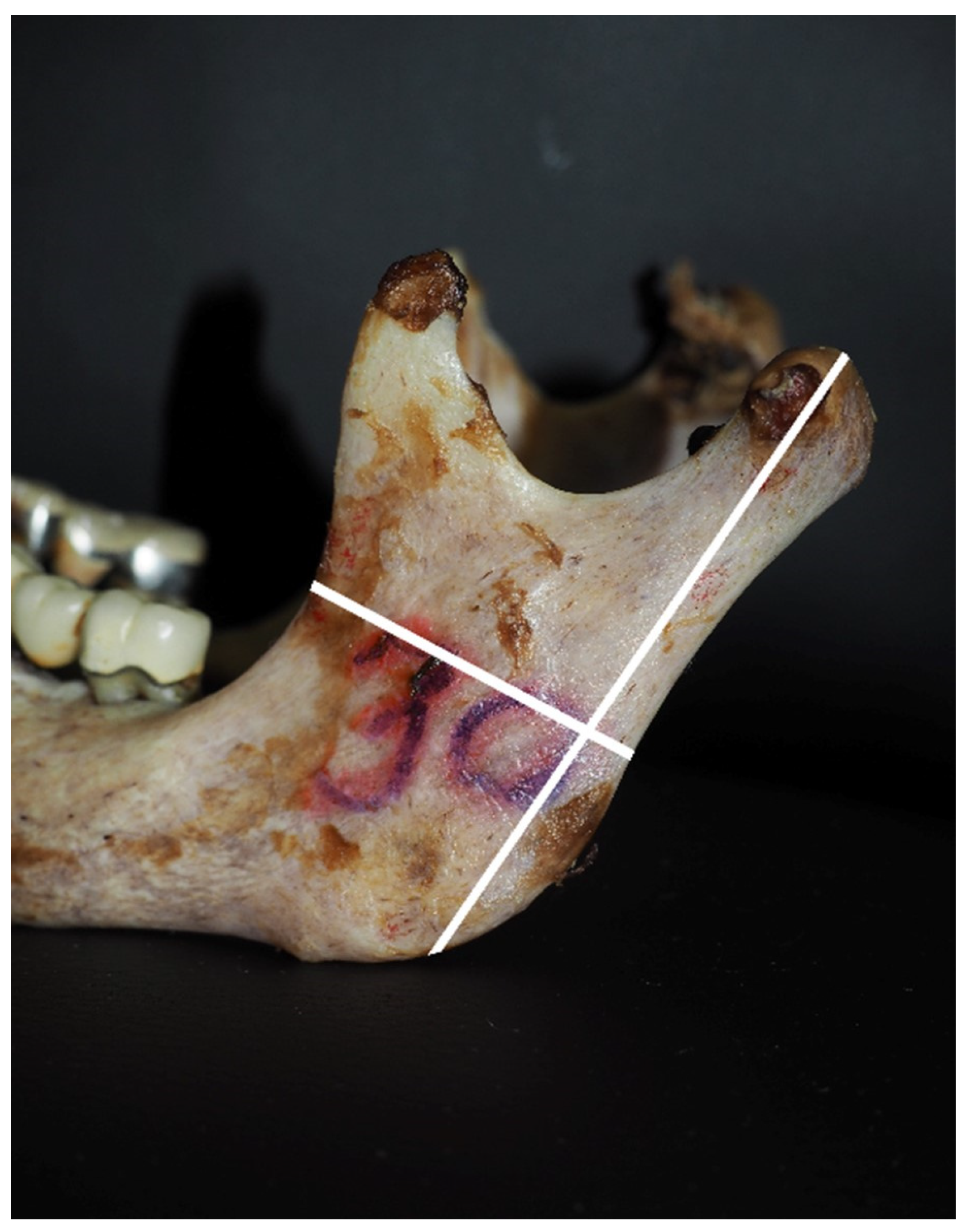 Medicina 60 01925 g001 Medicina 60 01925 g001