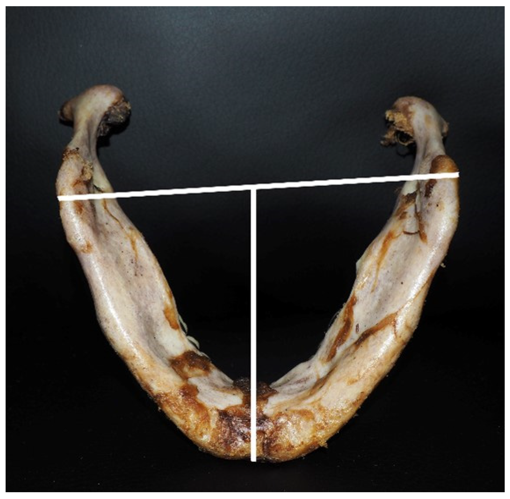 Medicina 60 01925 g002 Medicina 60 01925 g002