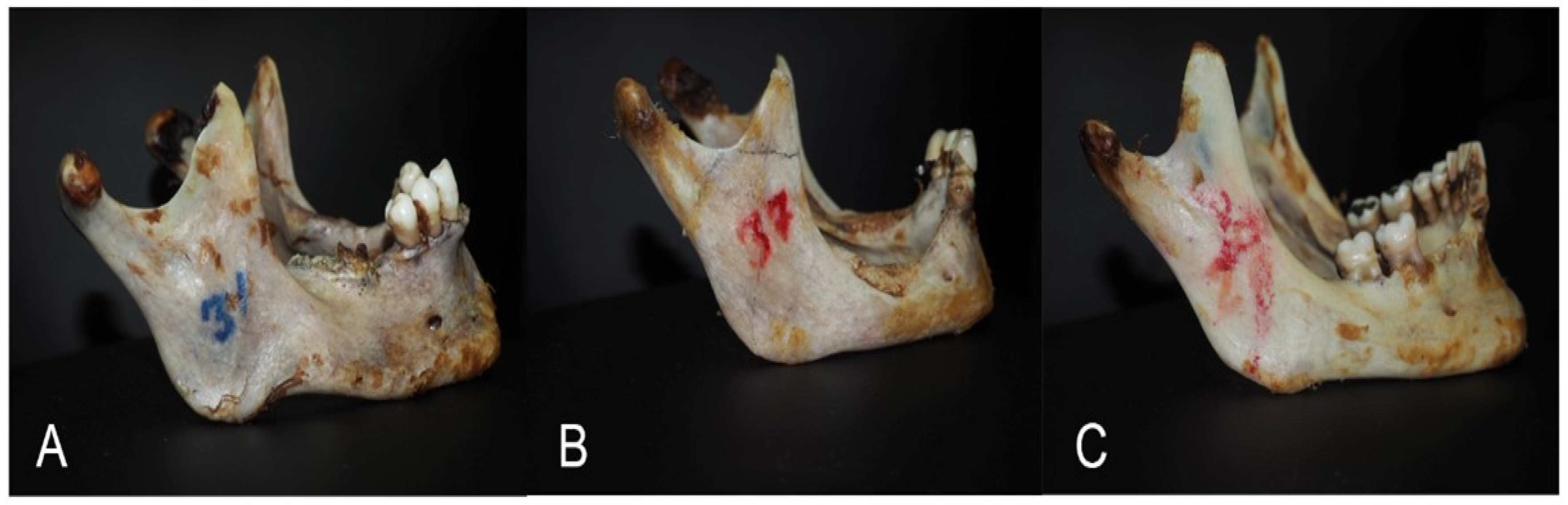 Medicina 60 01925 g003 Medicina 60 01925 g003