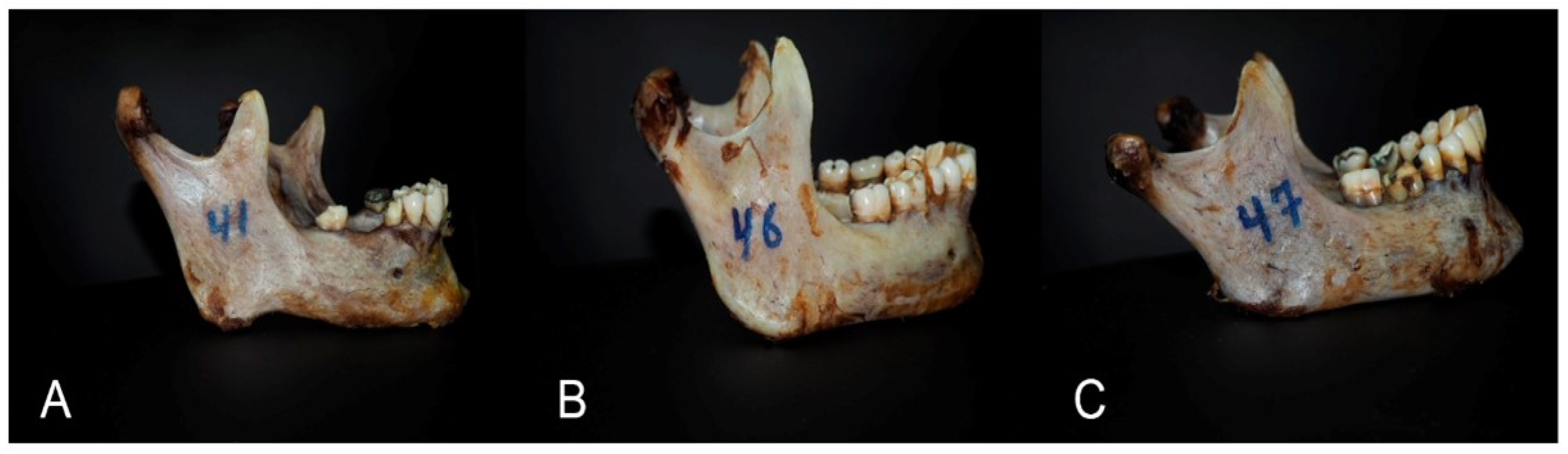 Medicina 60 01925 g005 Medicina 60 01925 g005