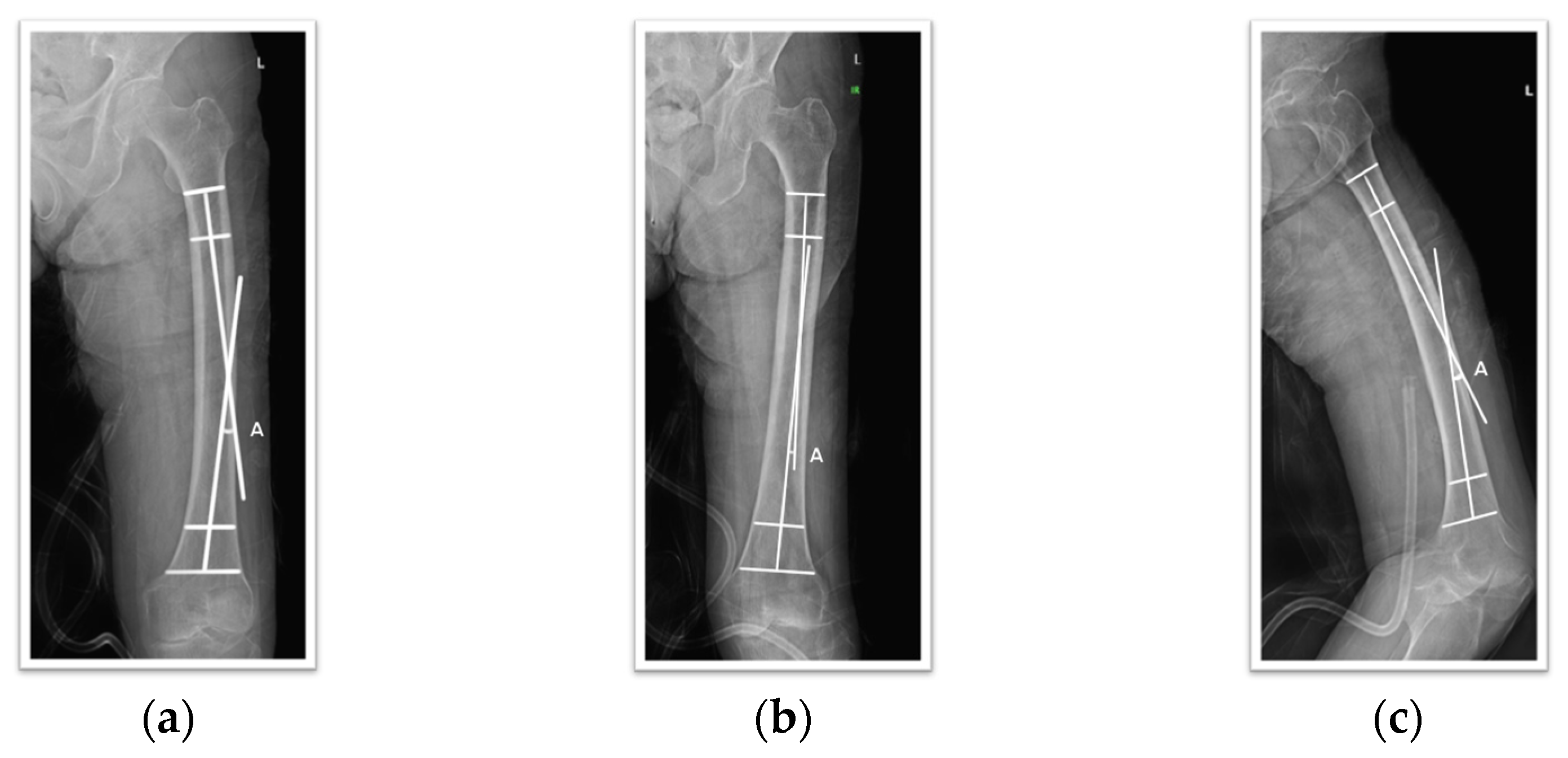Medicina 60 01930 g001