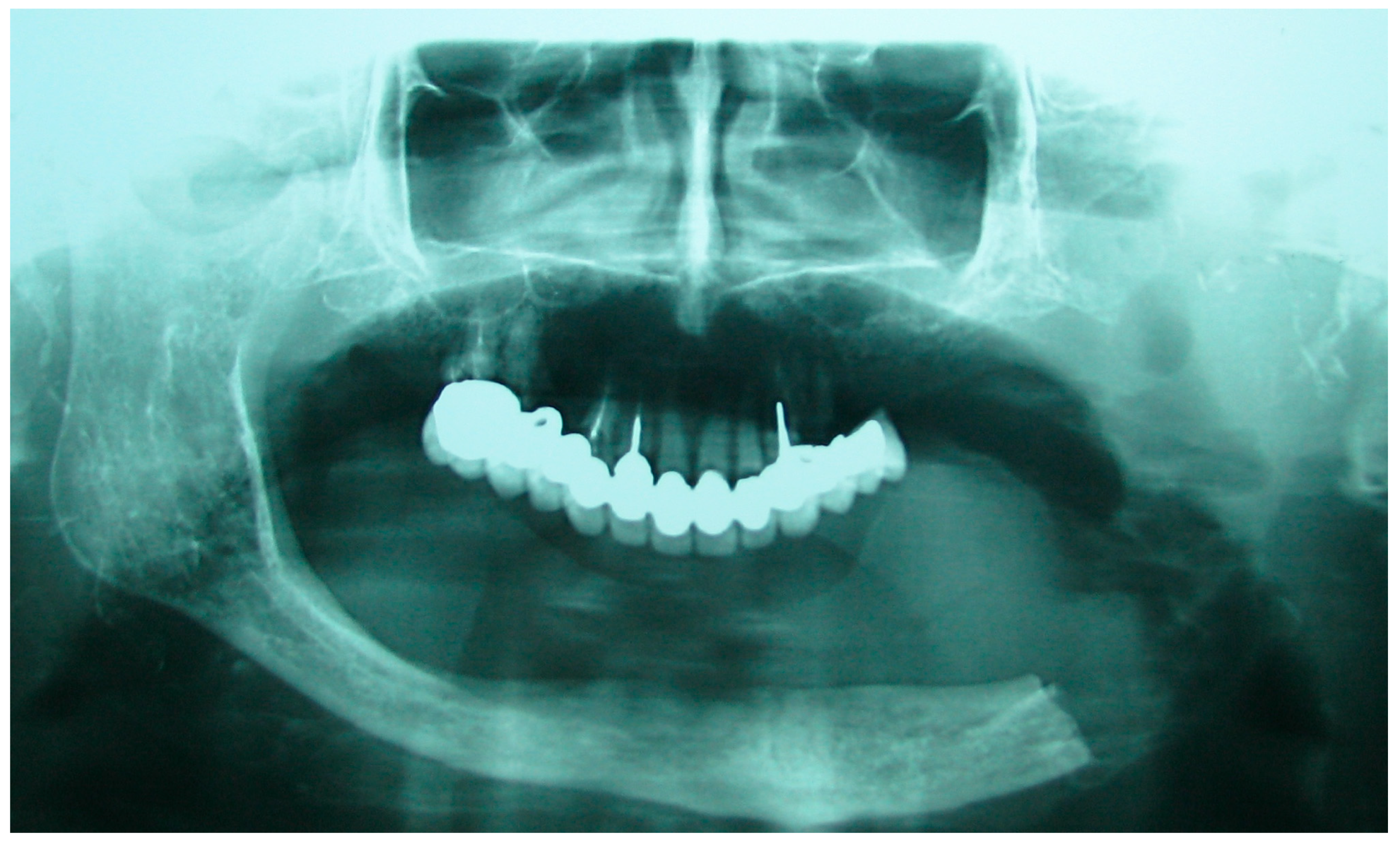 Medicina 60 01931 g002