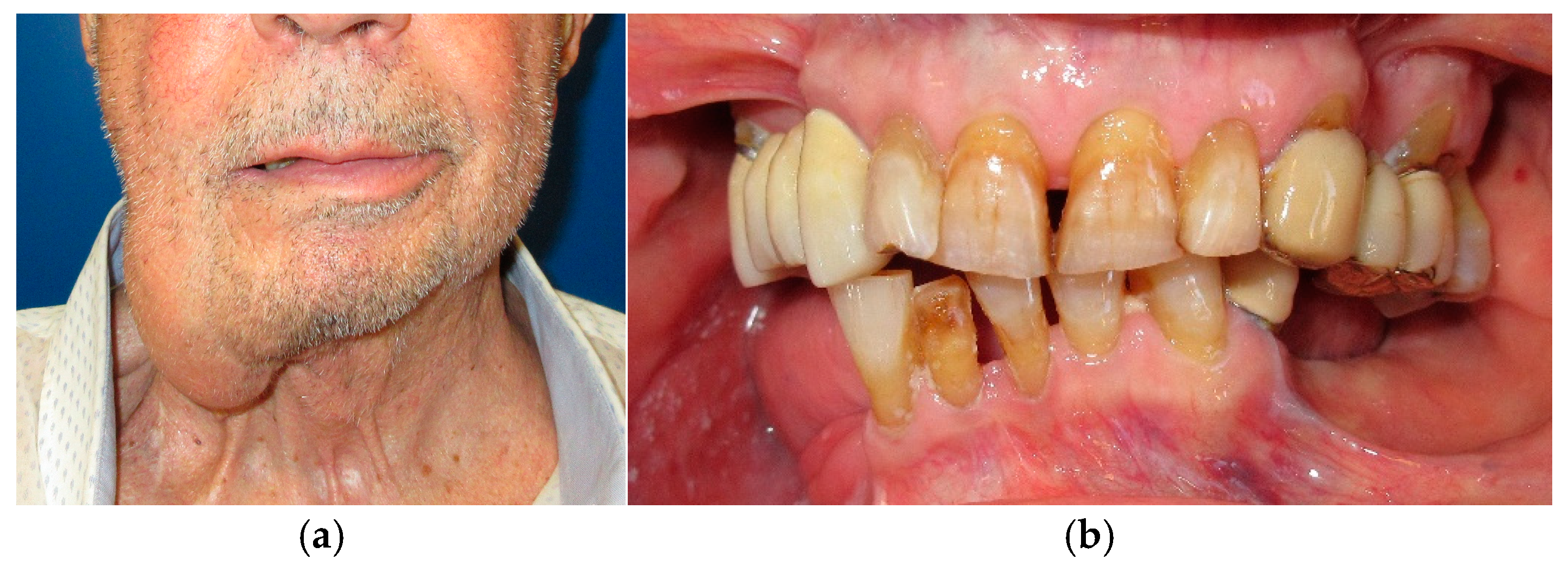 Medicina 60 01931 g005