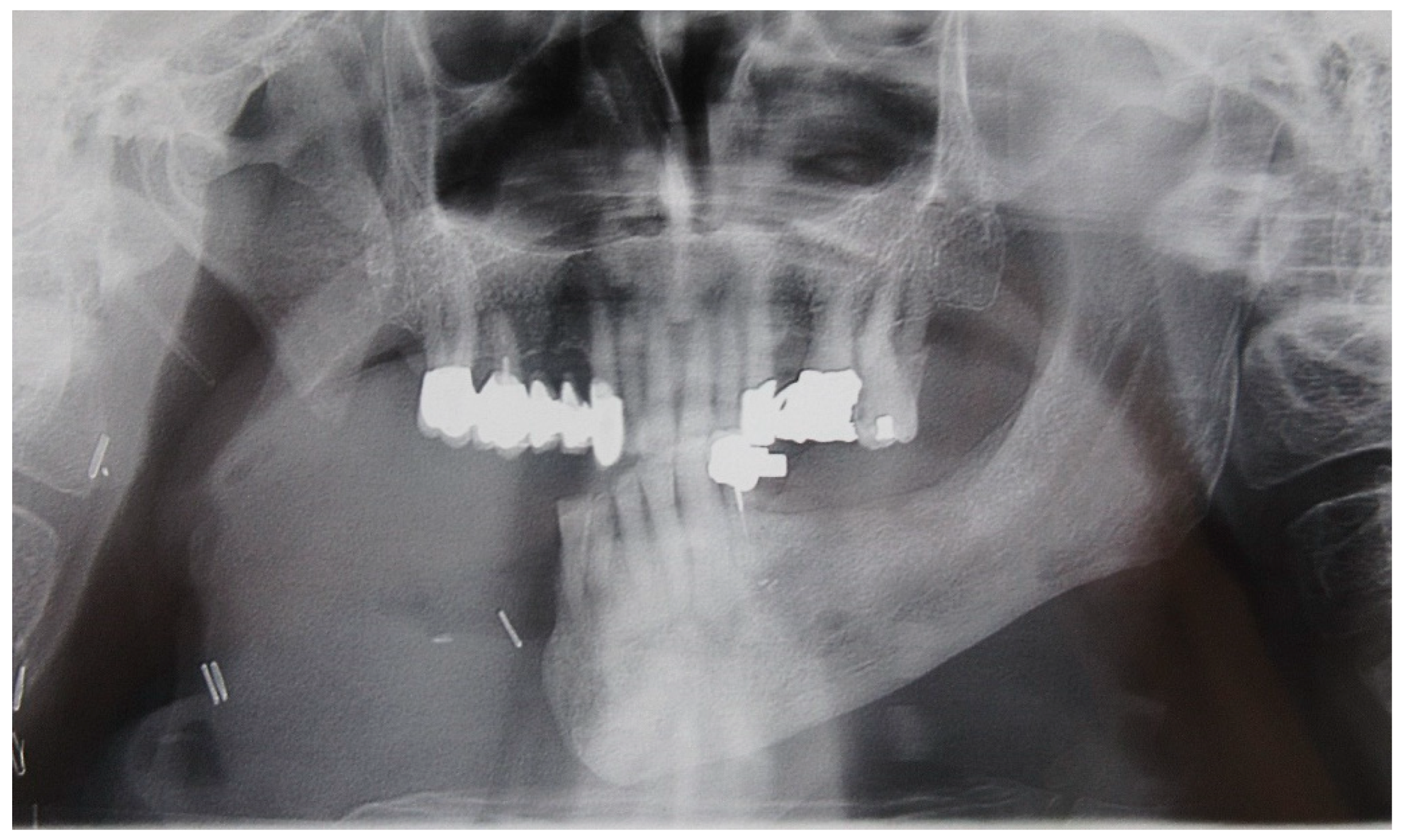 Medicina 60 01931 g006