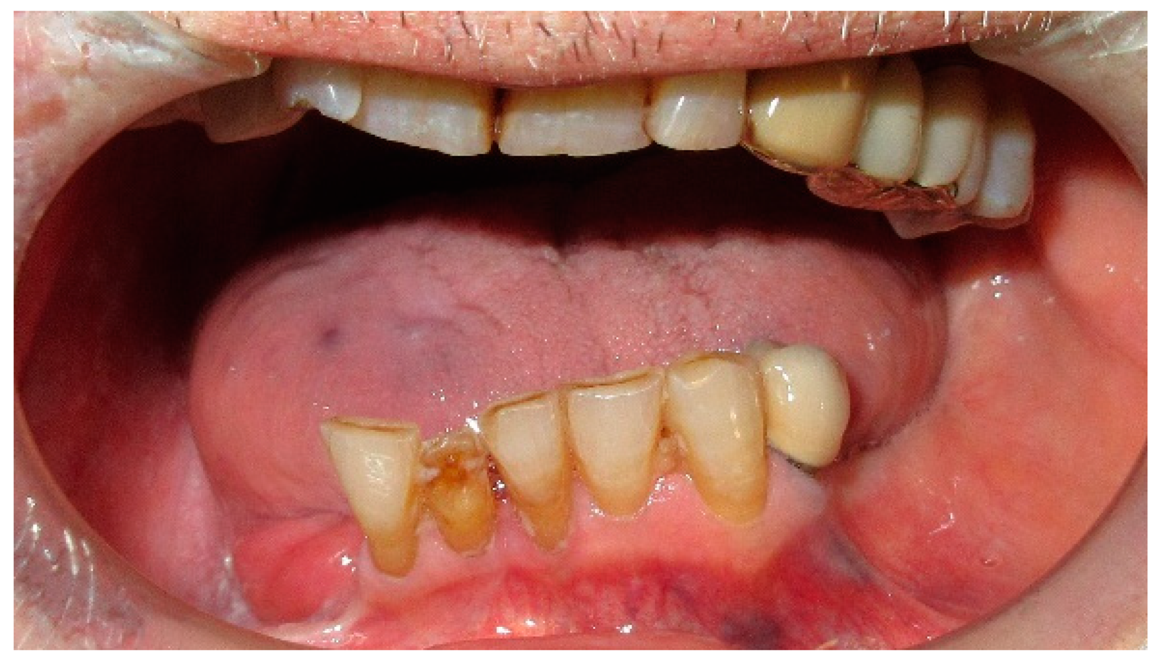 Medicina 60 01931 g007