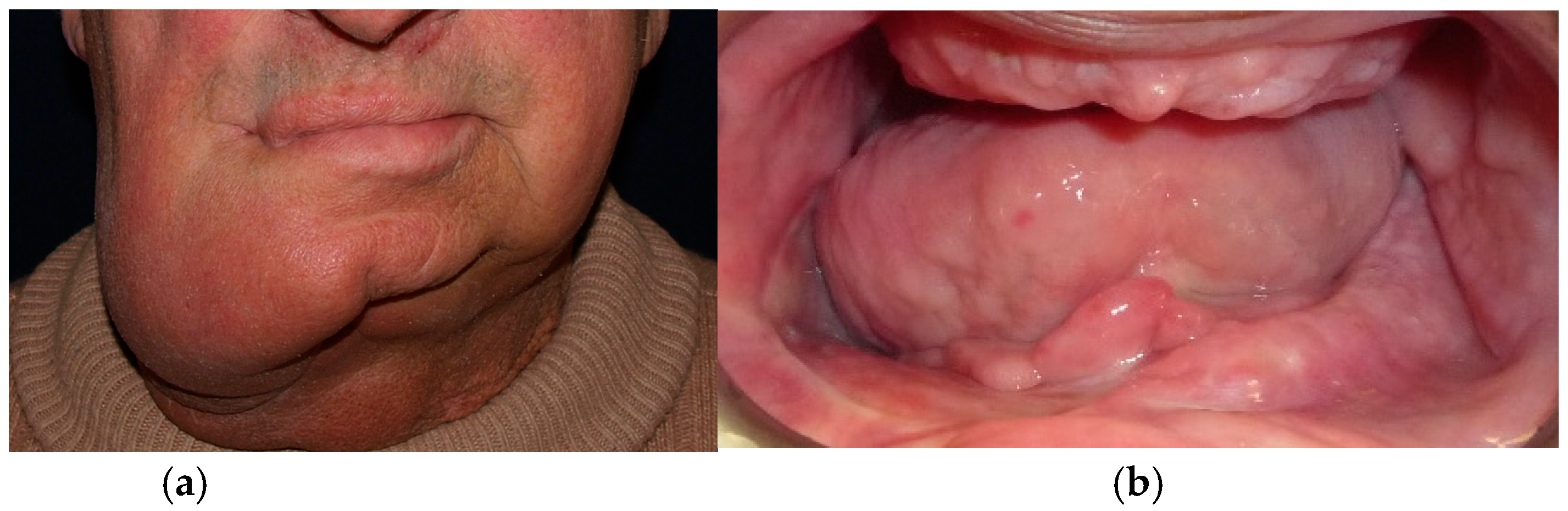 Medicina 60 01931 g010