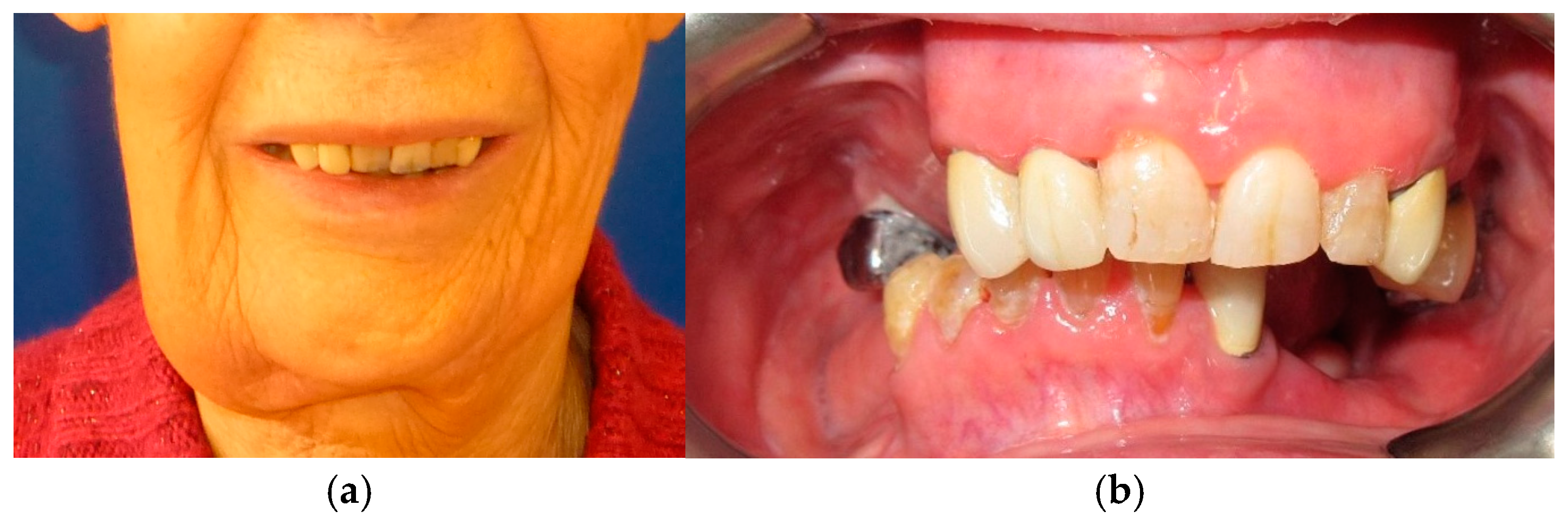 Medicina 60 01931 g013