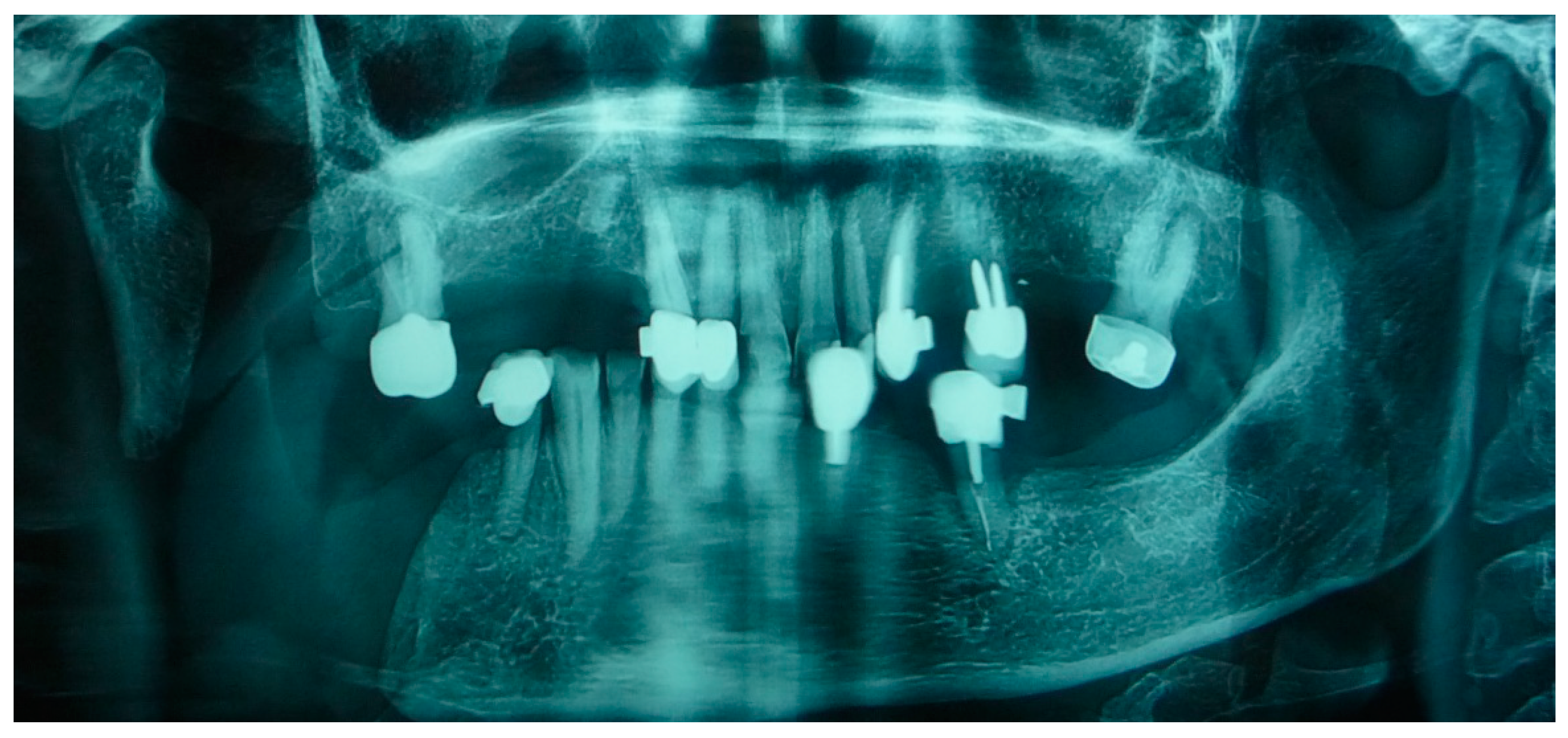 Medicina 60 01931 g014