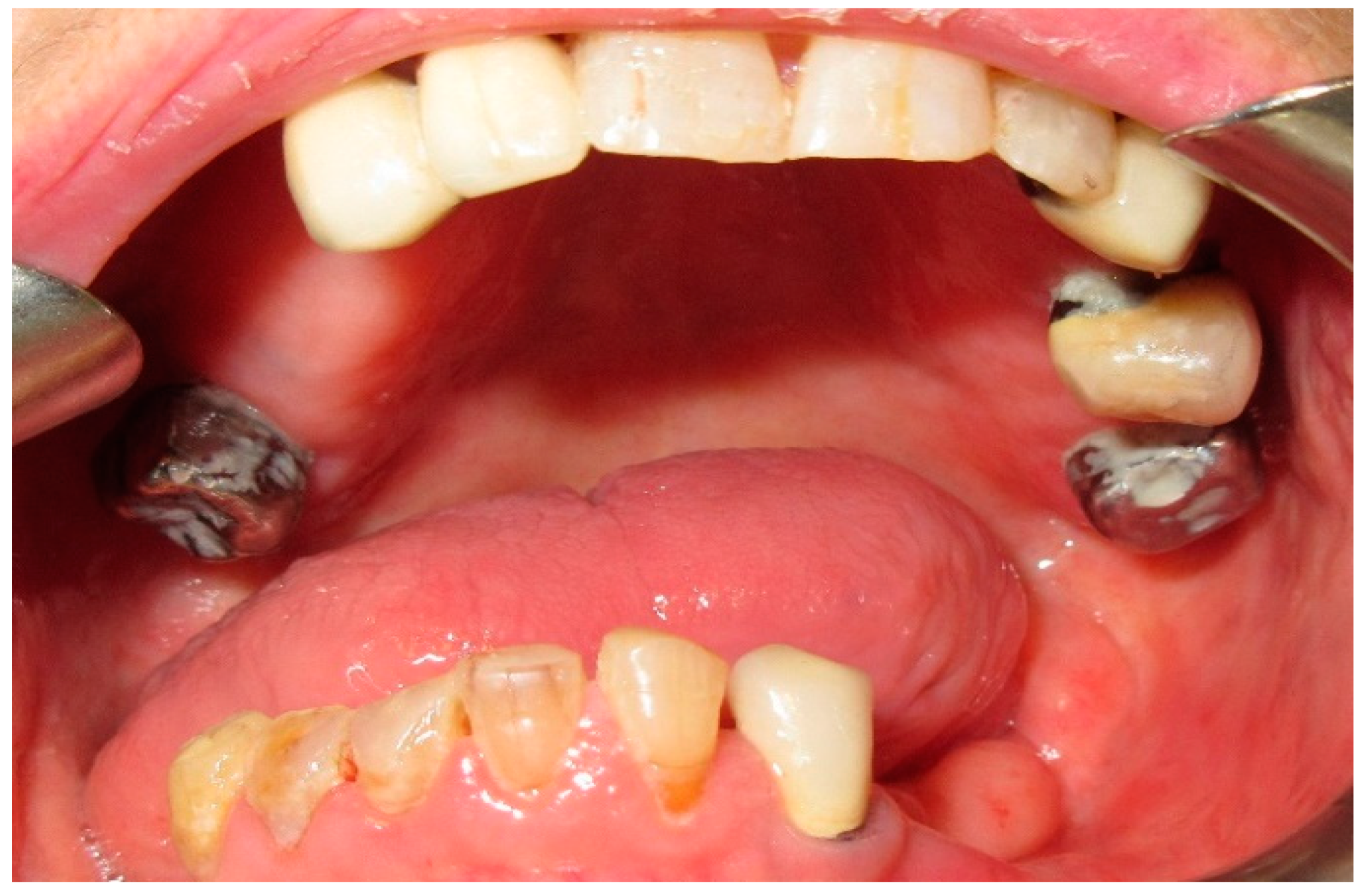 Medicina 60 01931 g015