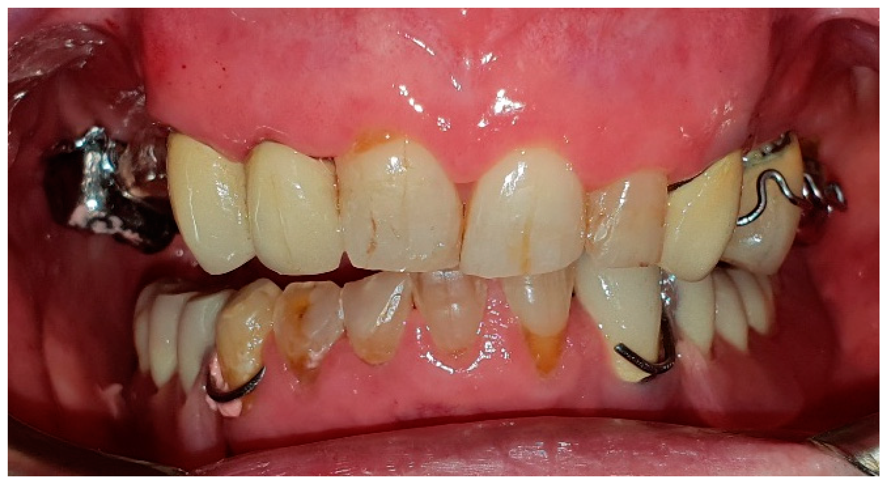 Medicina 60 01931 g017