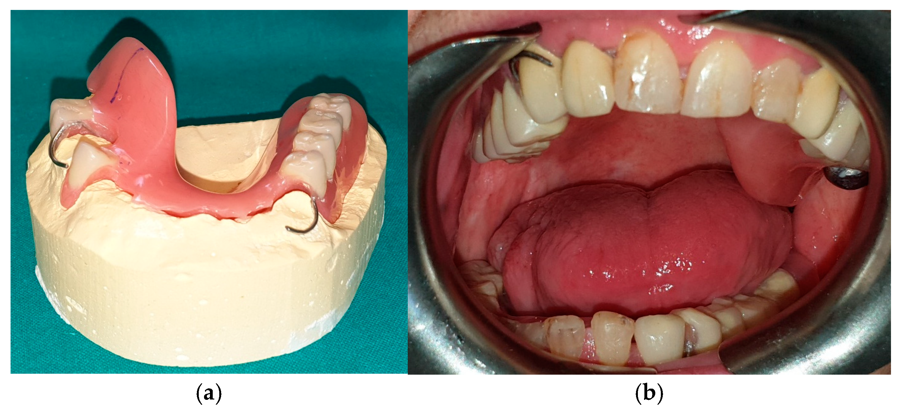 Medicina 60 01931 g018