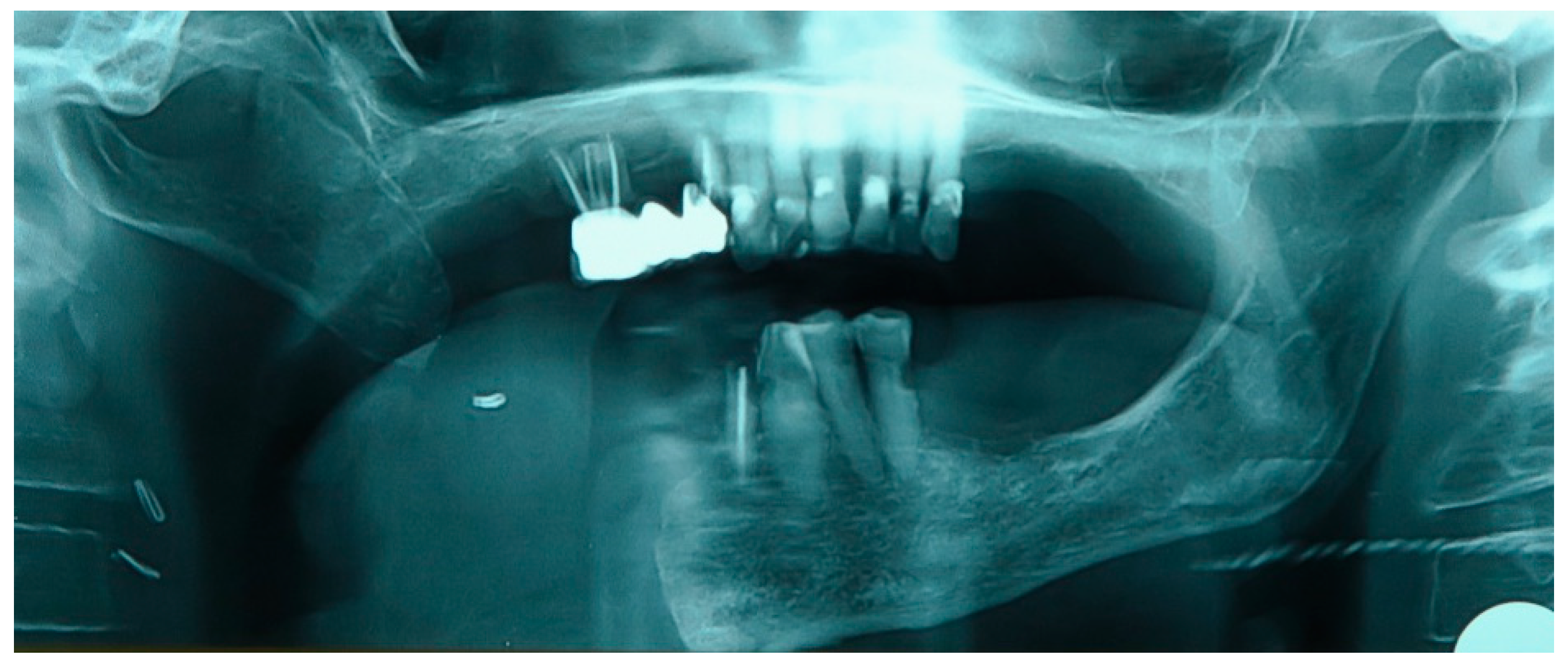 Medicina 60 01931 g022