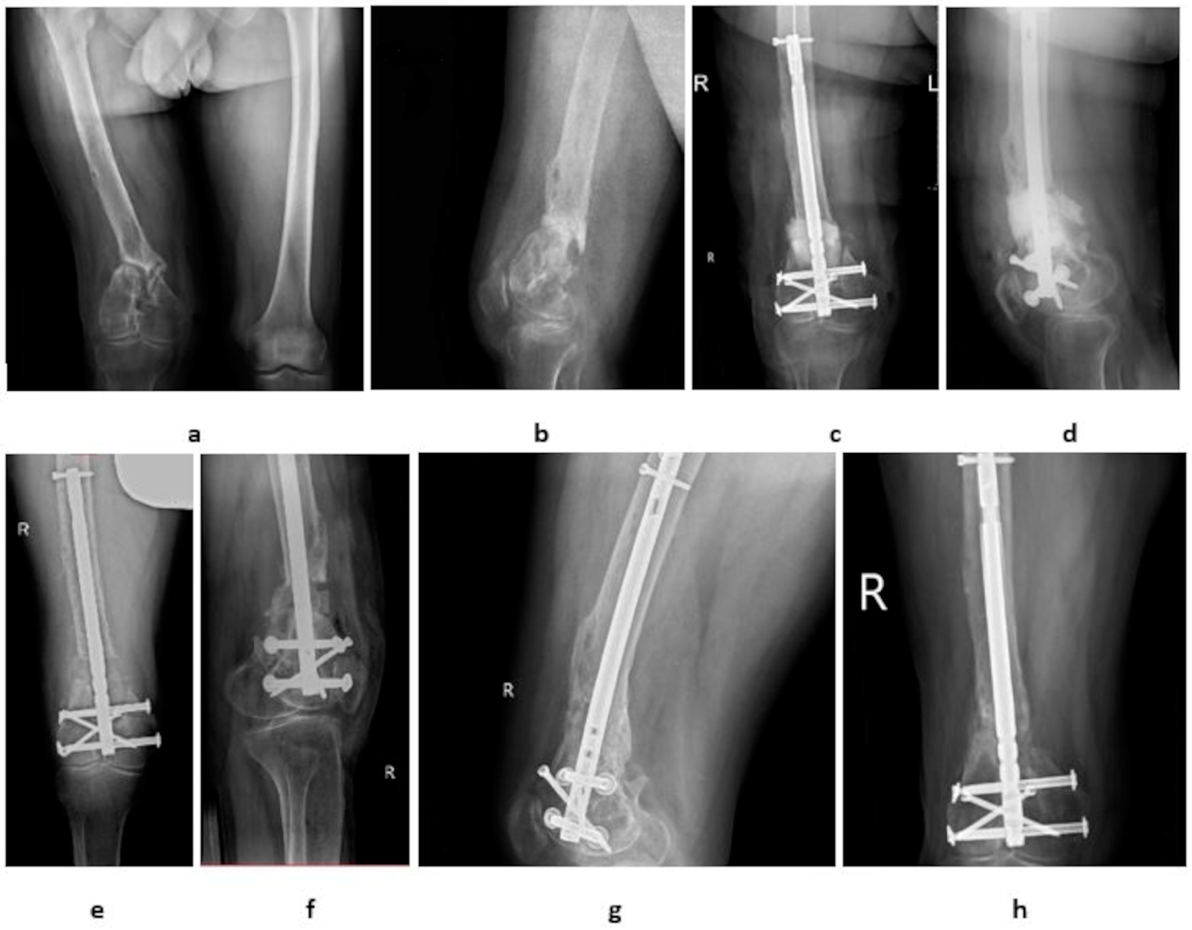 Medicina 60 01933 g001