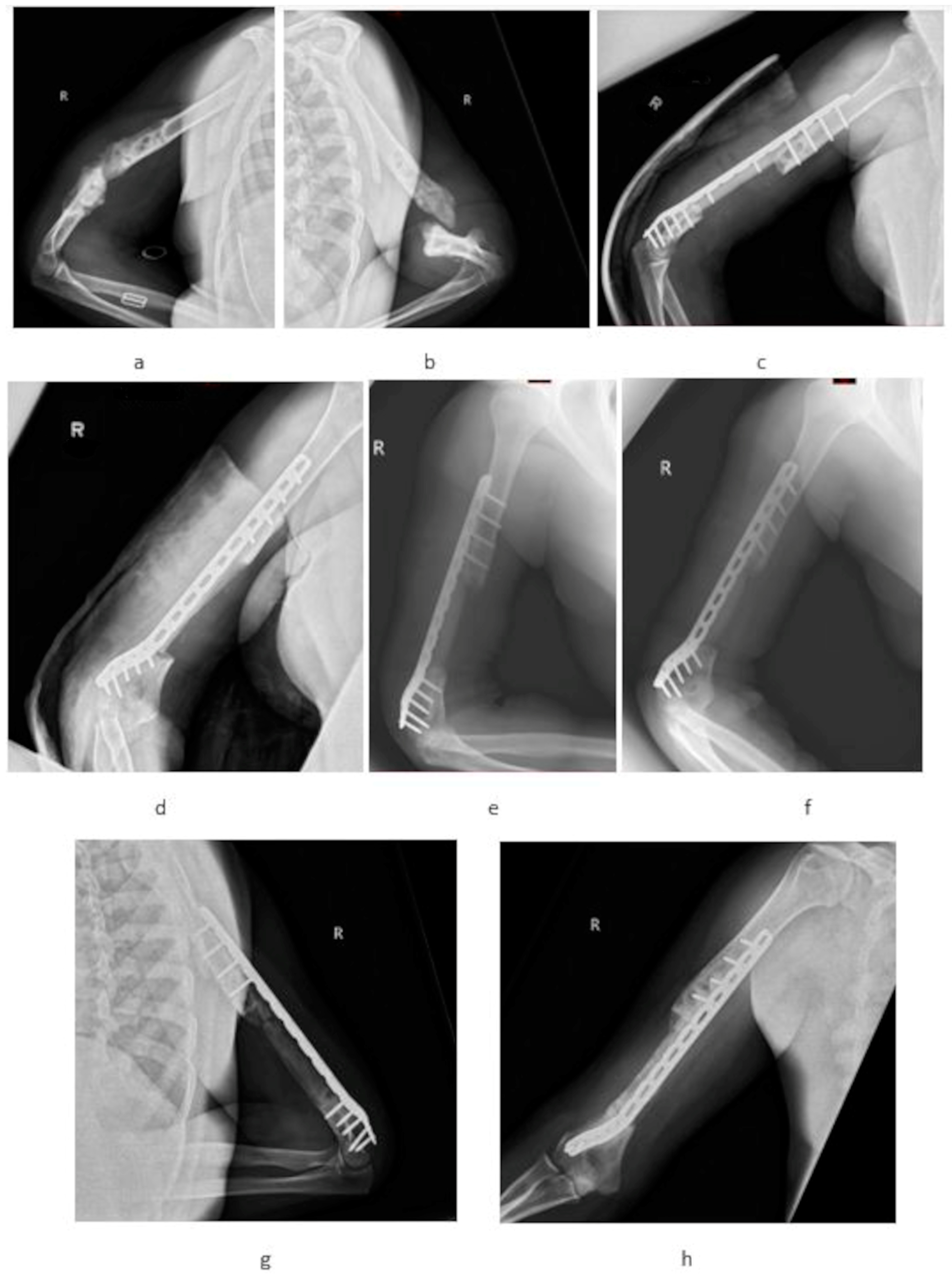 Medicina 60 01933 g002