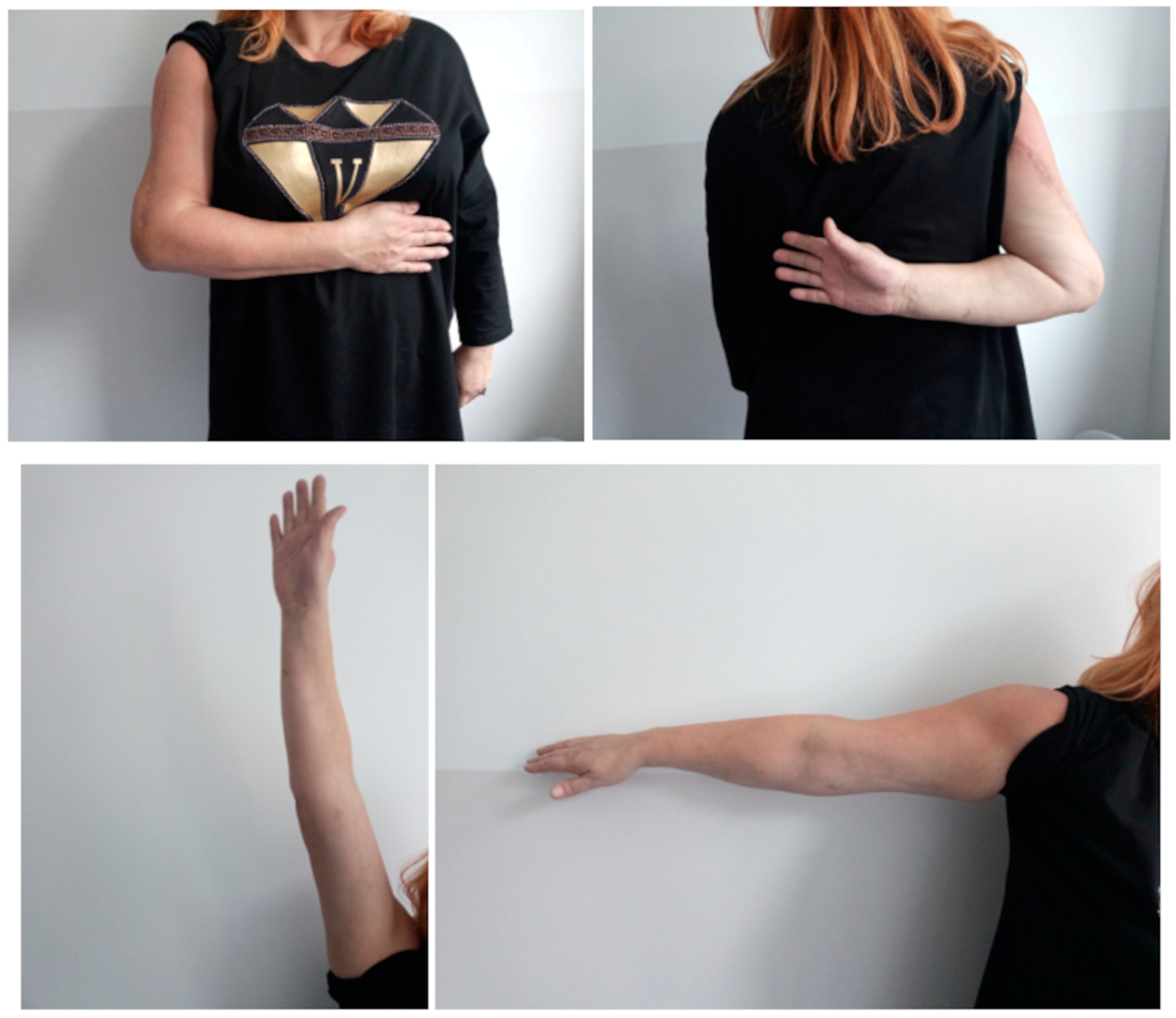 Medicina 60 01933 g003