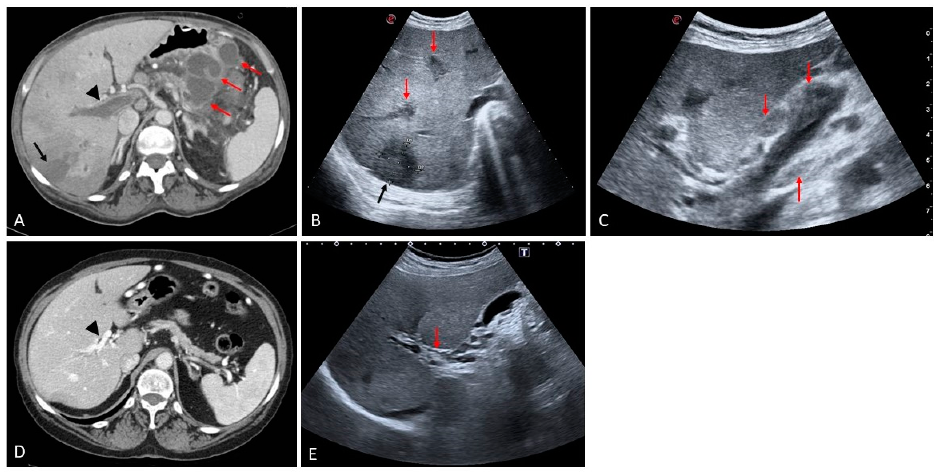 Medicina 60 01955 g004