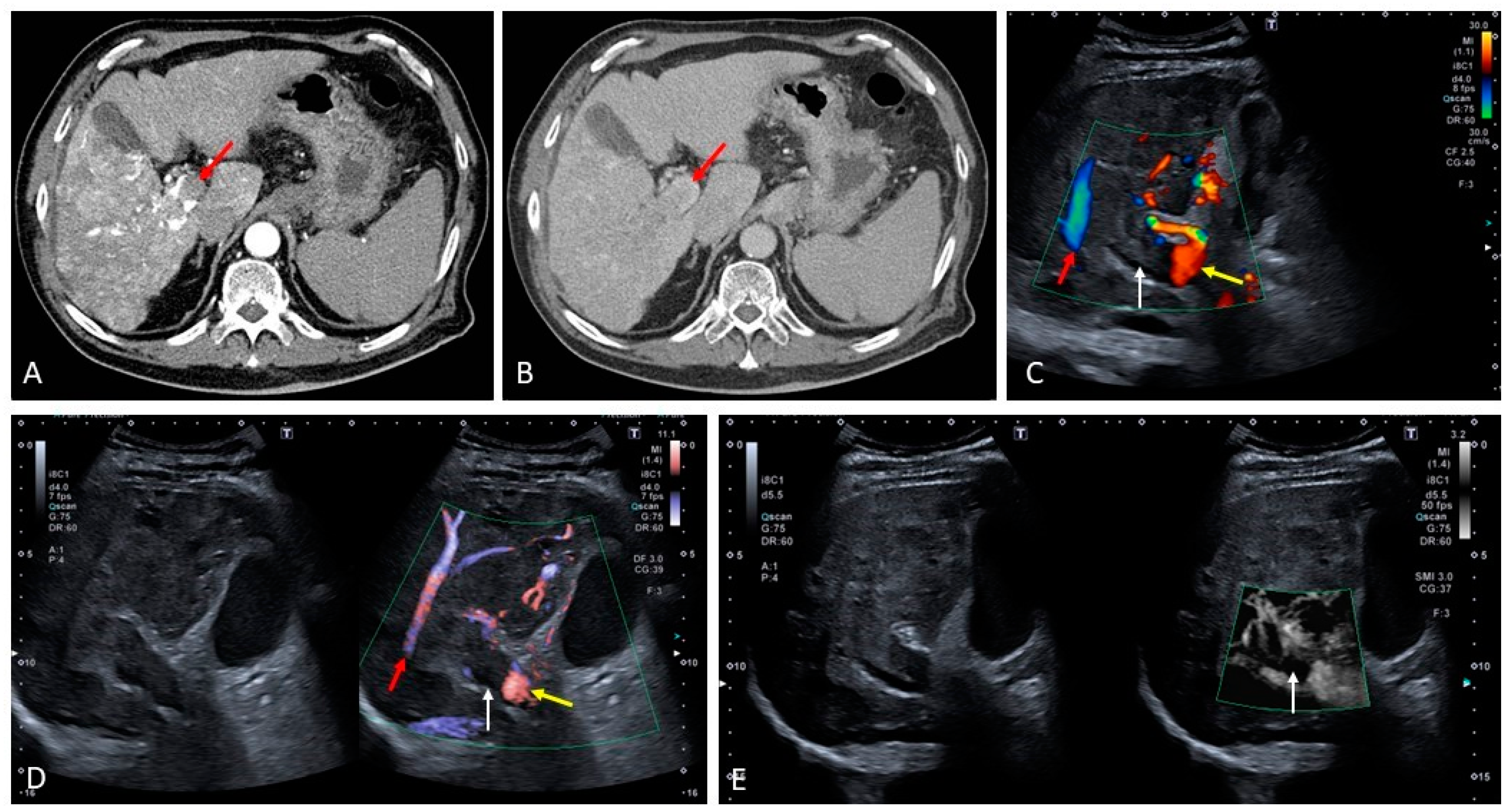 Medicina 60 01955 g007