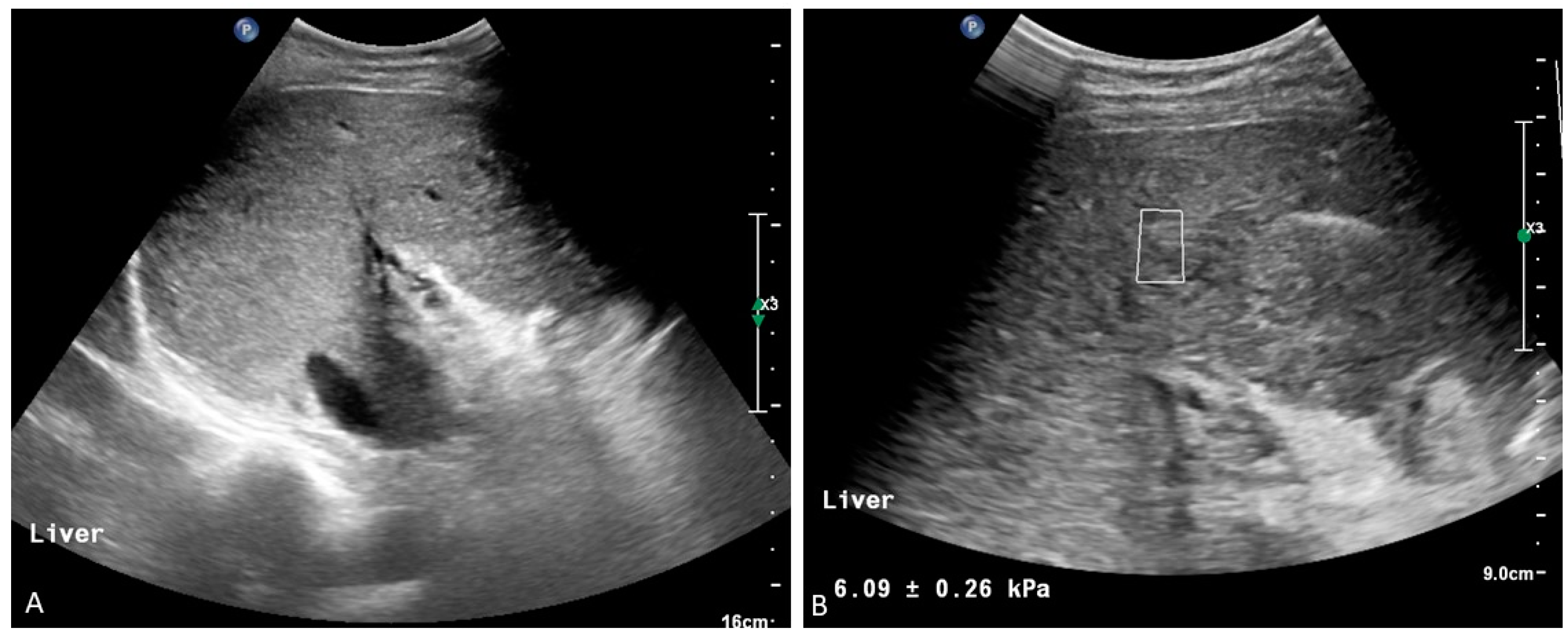 Medicina 60 01955 g009