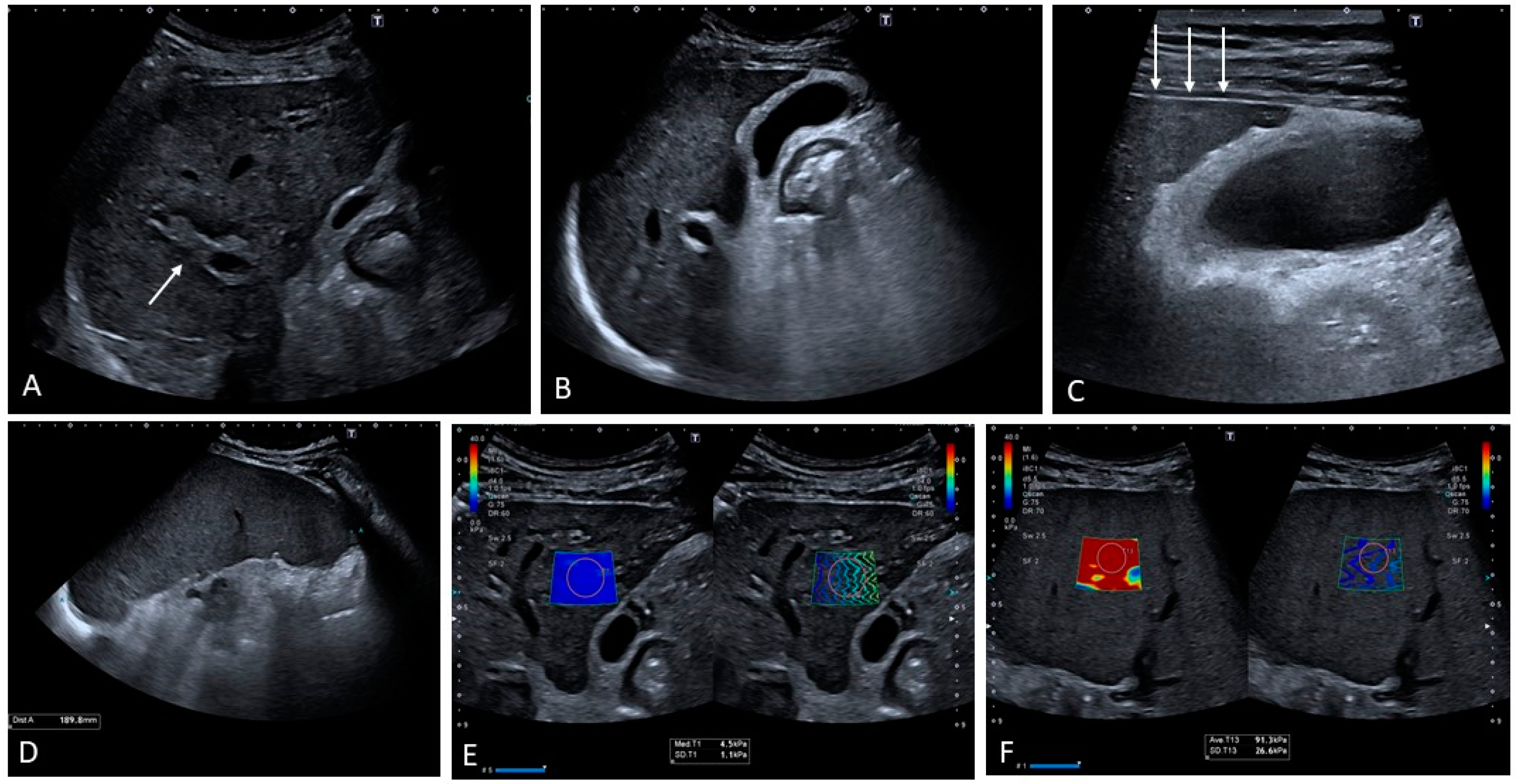 Medicina 60 01955 g011