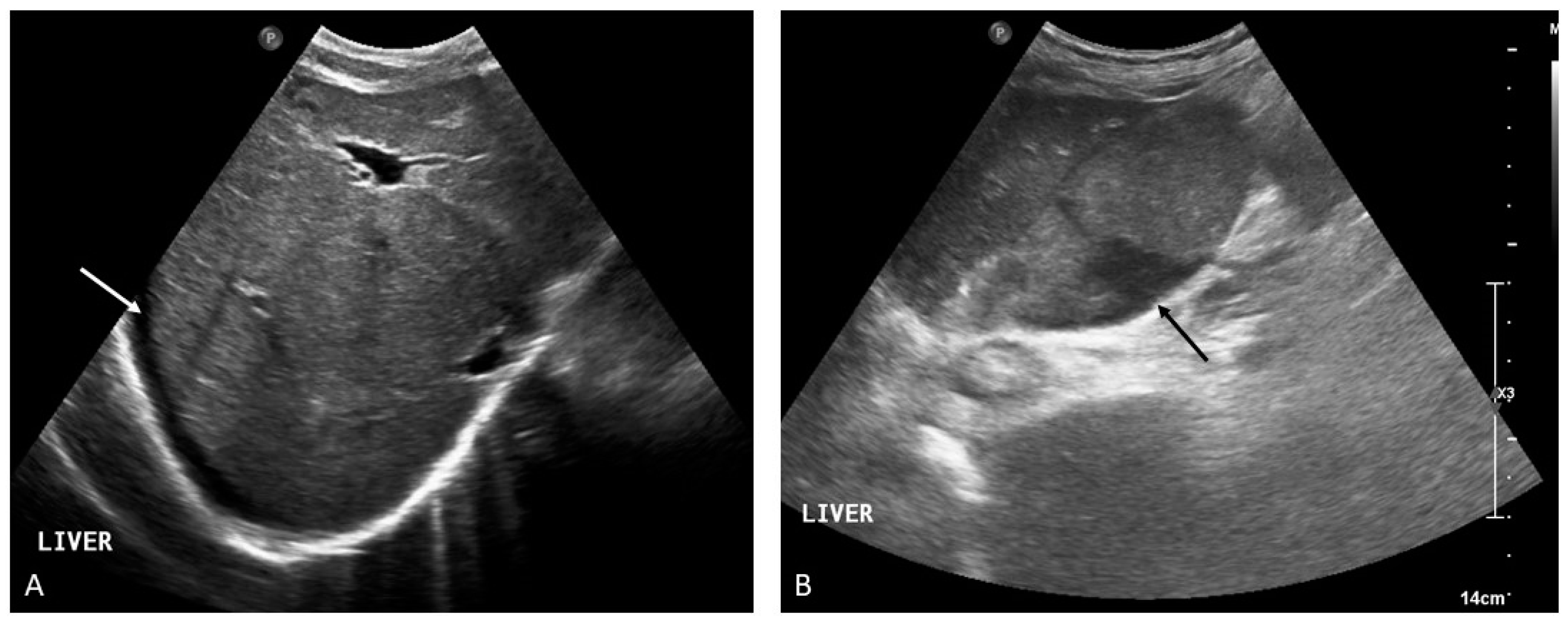 Medicina 60 01955 g013