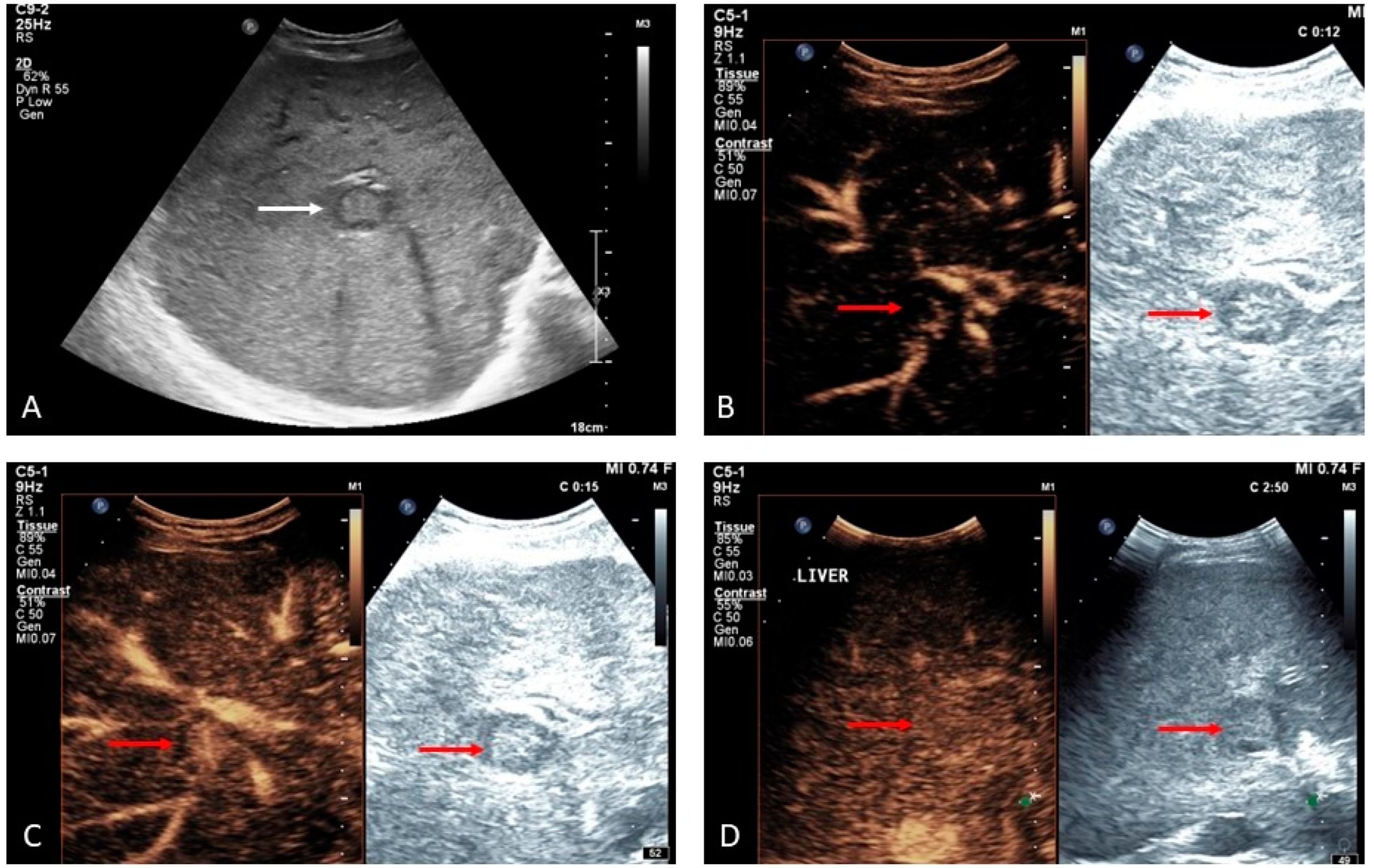 Medicina 60 01955 g015