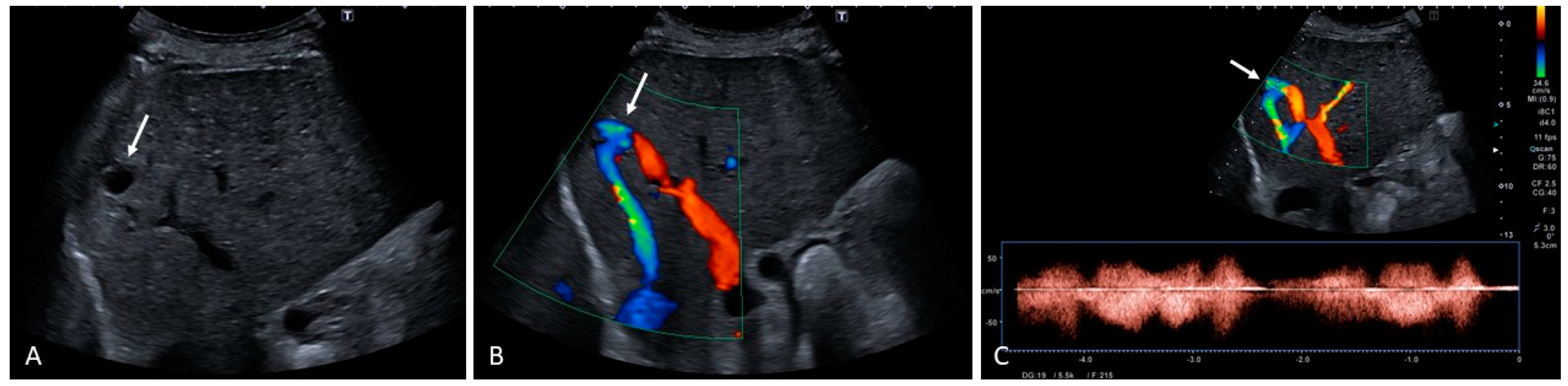 Medicina 60 01955 g020