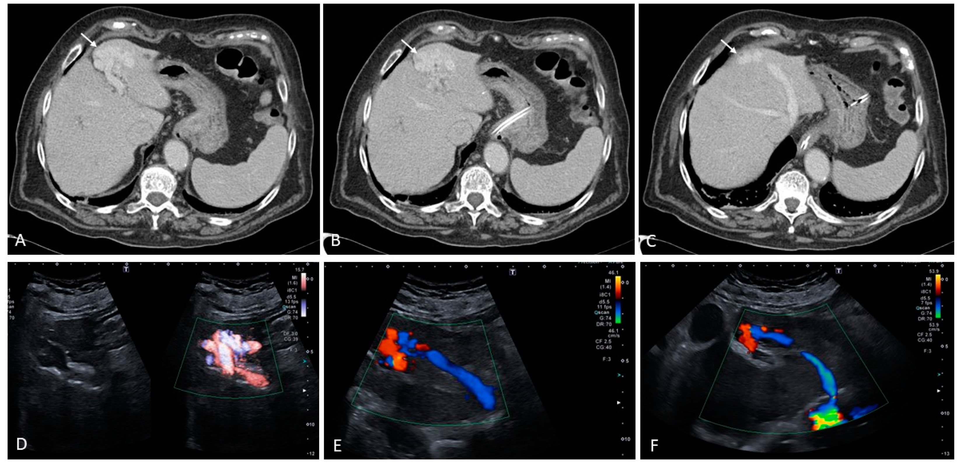 Medicina 60 01955 g021