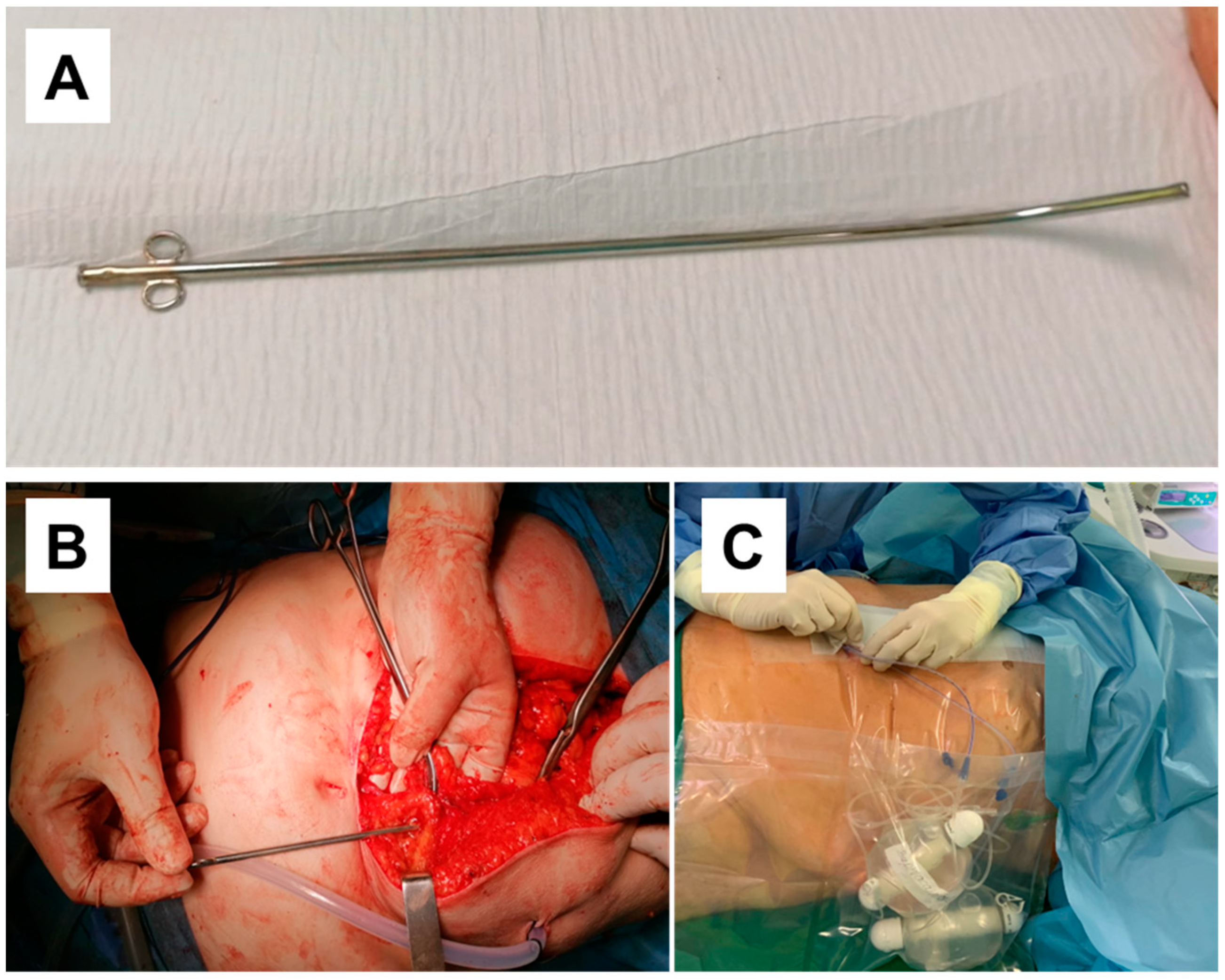 Medicina 60 01992 g002