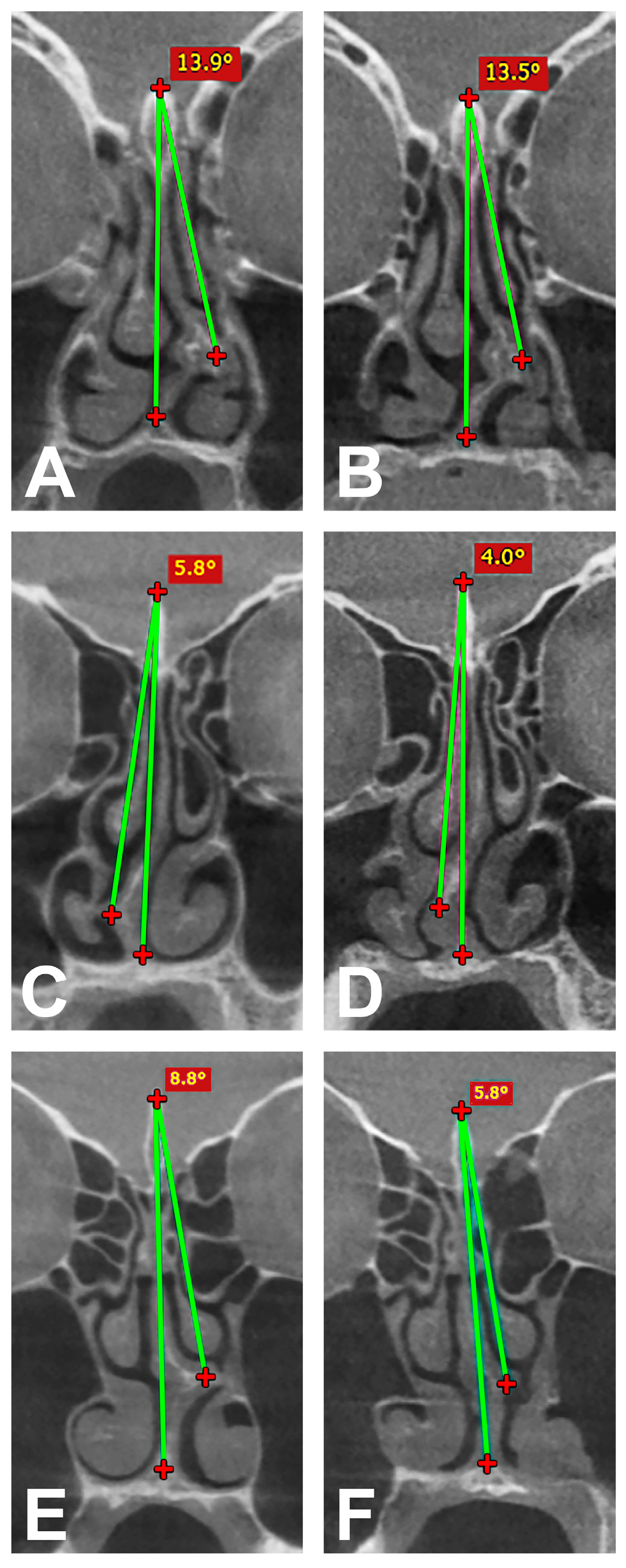 Medicina 60 02000 g003