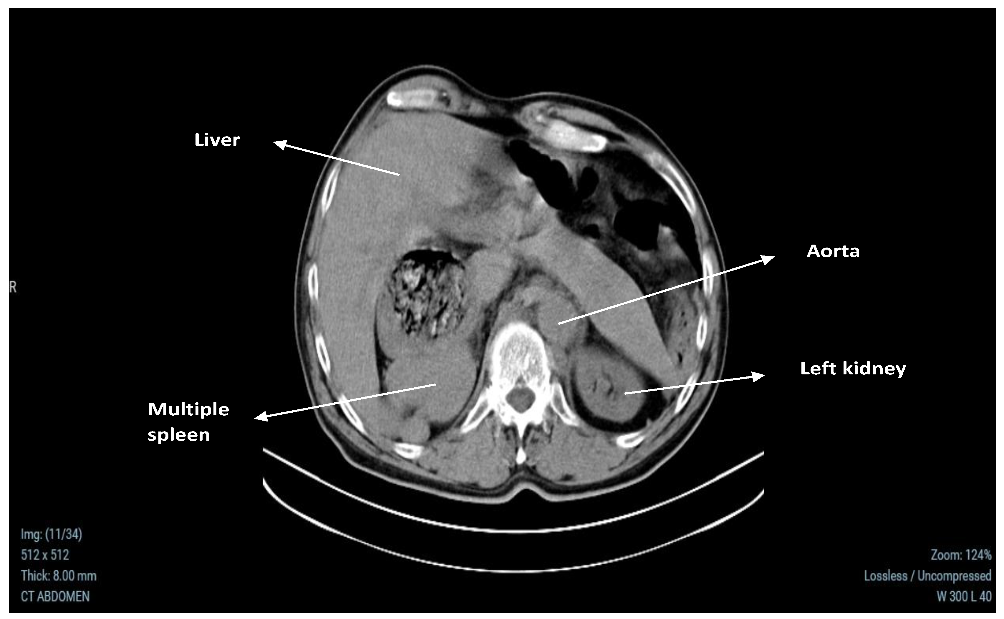 Medicina 60 02010 g001