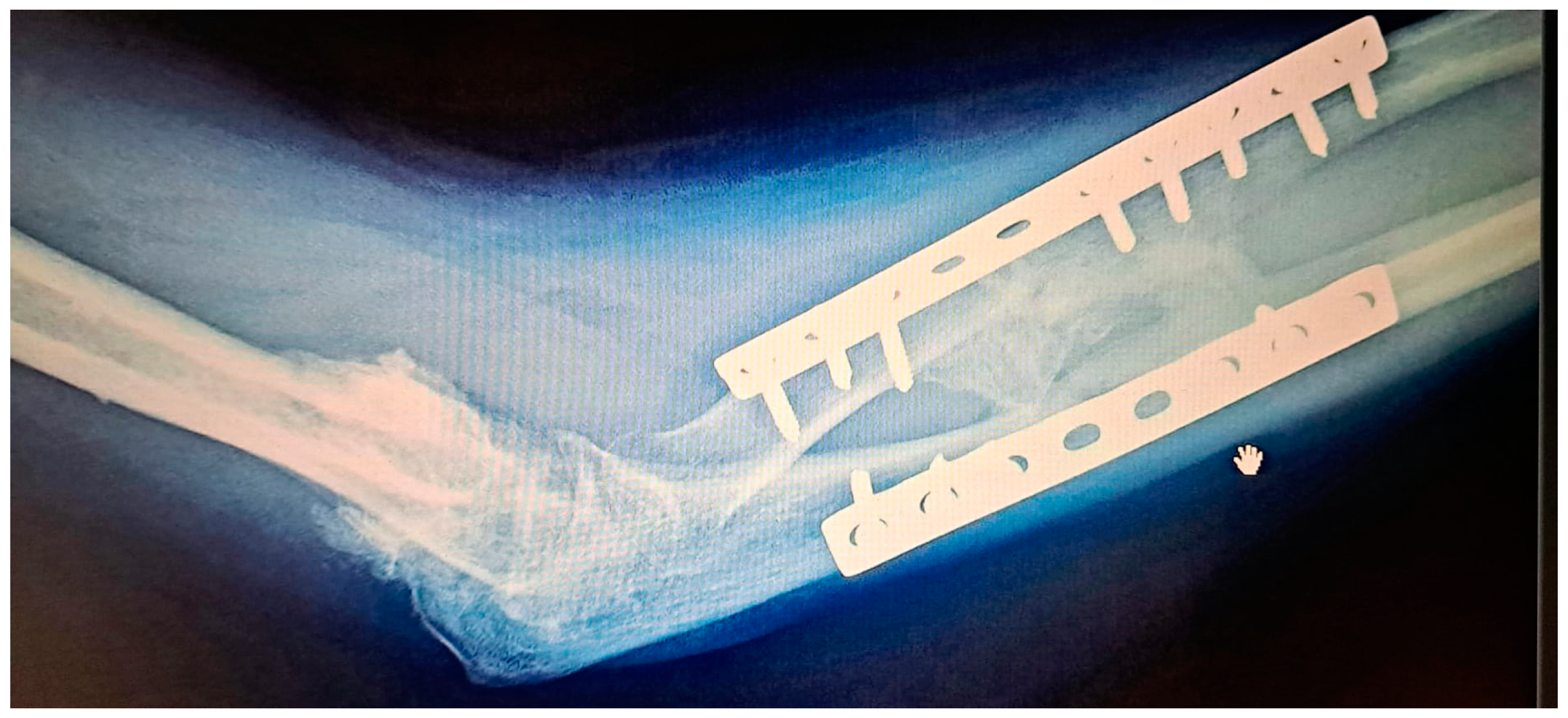 Medicina 60 02026 g001