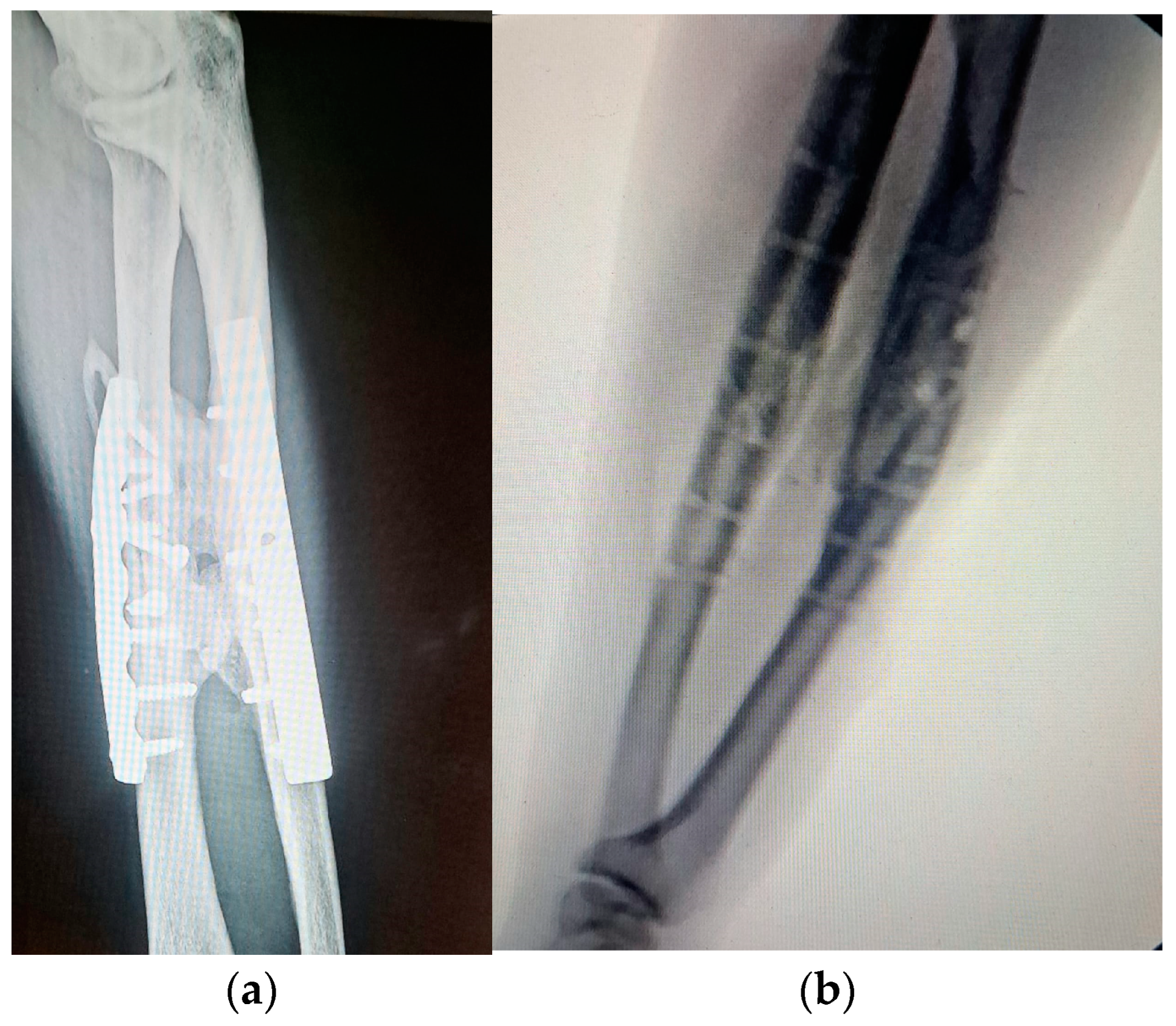 Medicina 60 02026 g004