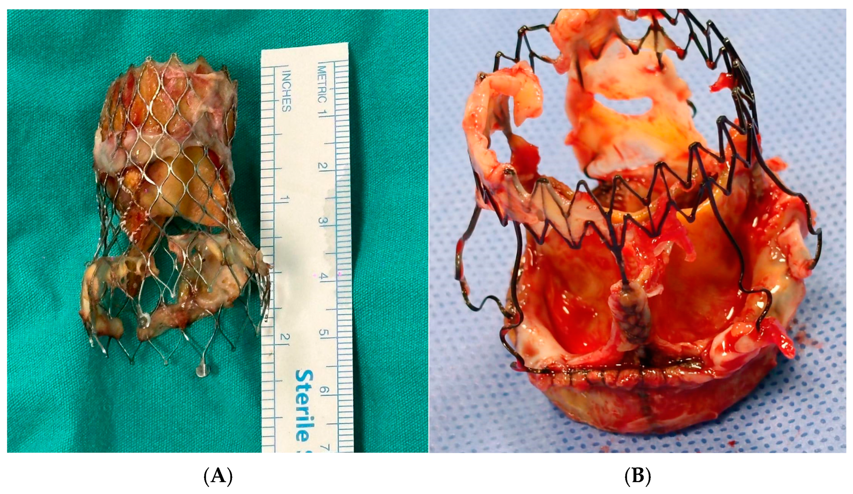 Medicina 60 02037 g001