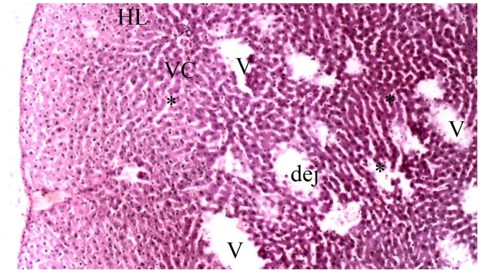 Medicina 60 02044 g005