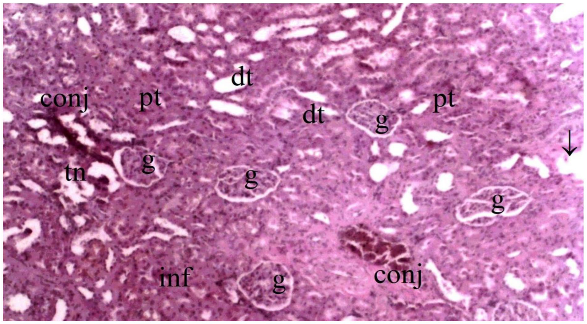 Medicina 60 02044 g010