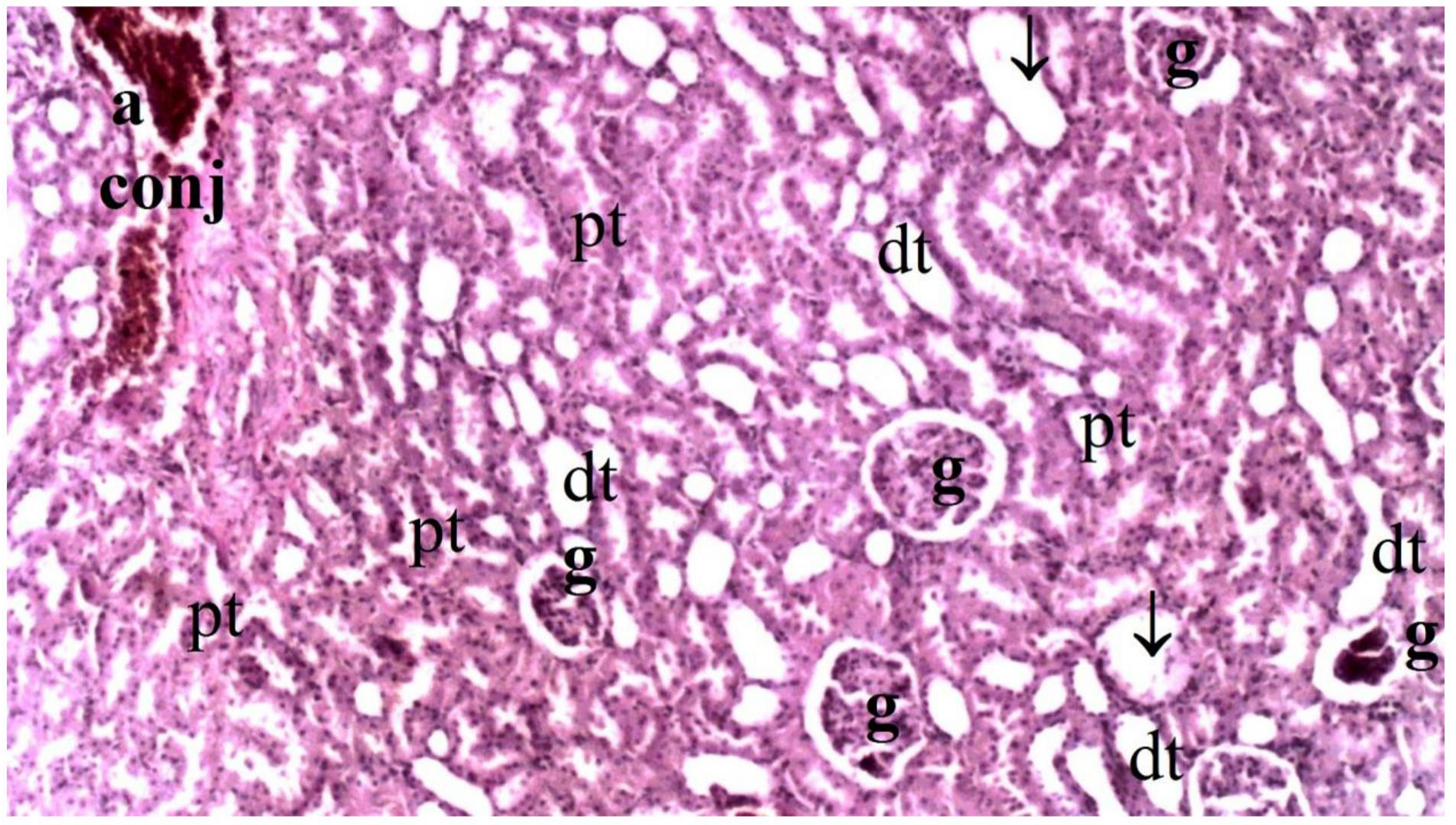 Medicina 60 02044 g011