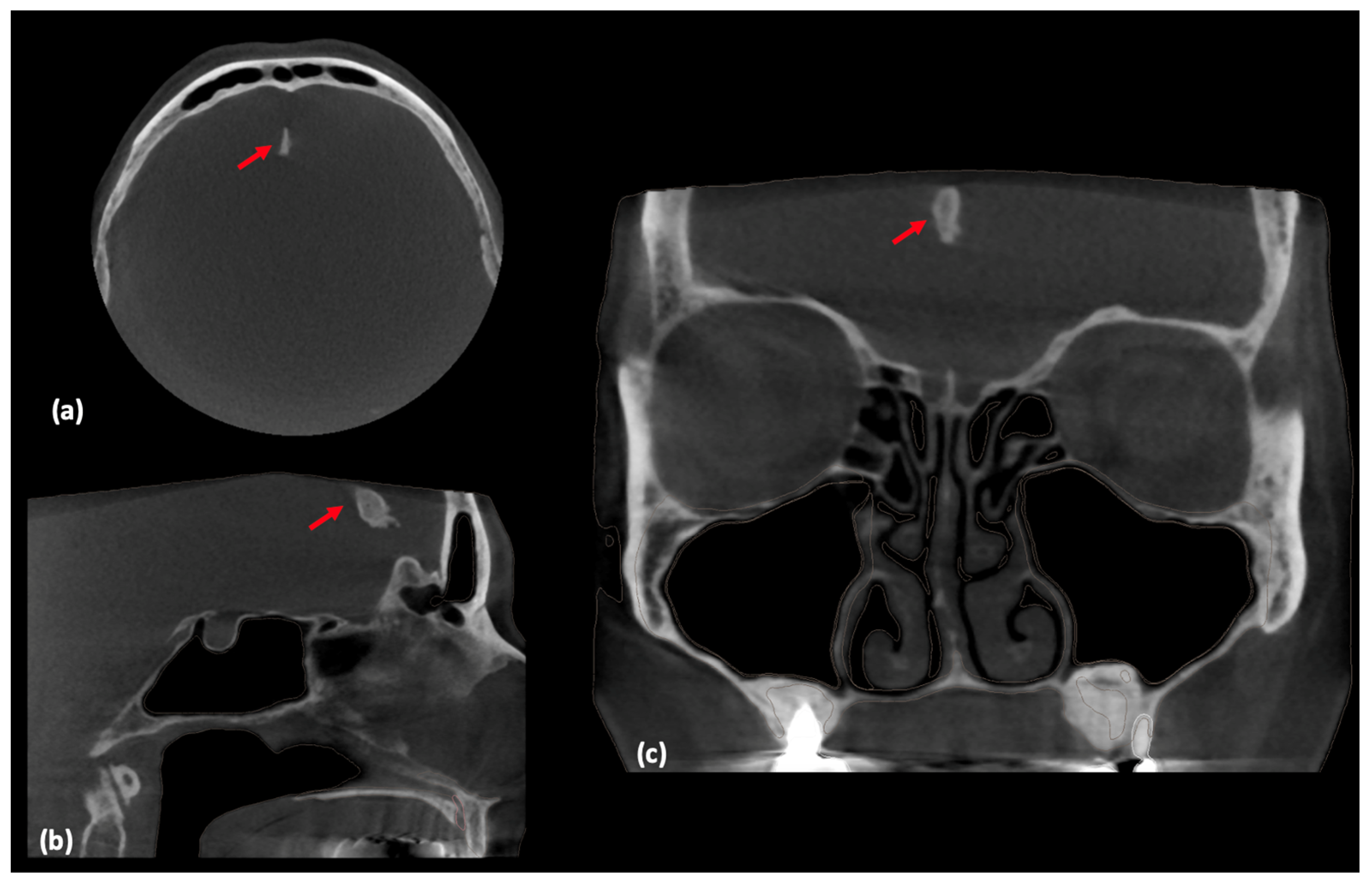 Medicina 60 02048 g001