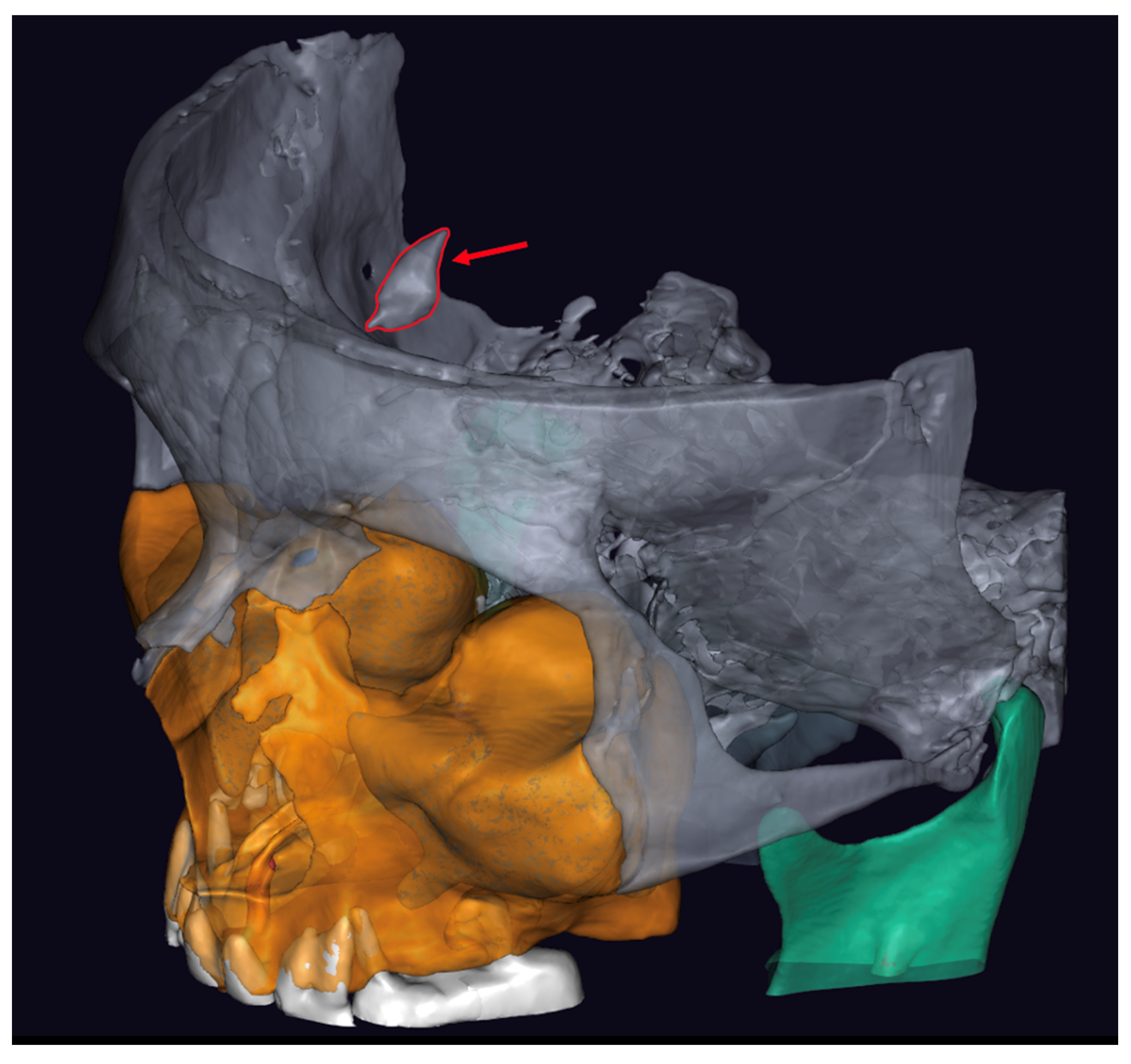 Medicina 60 02048 g002
