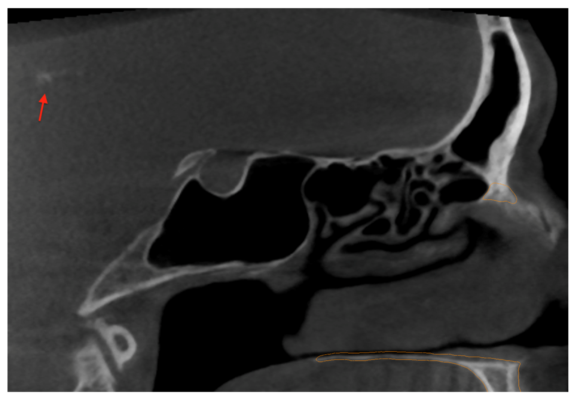 Medicina 60 02048 g003