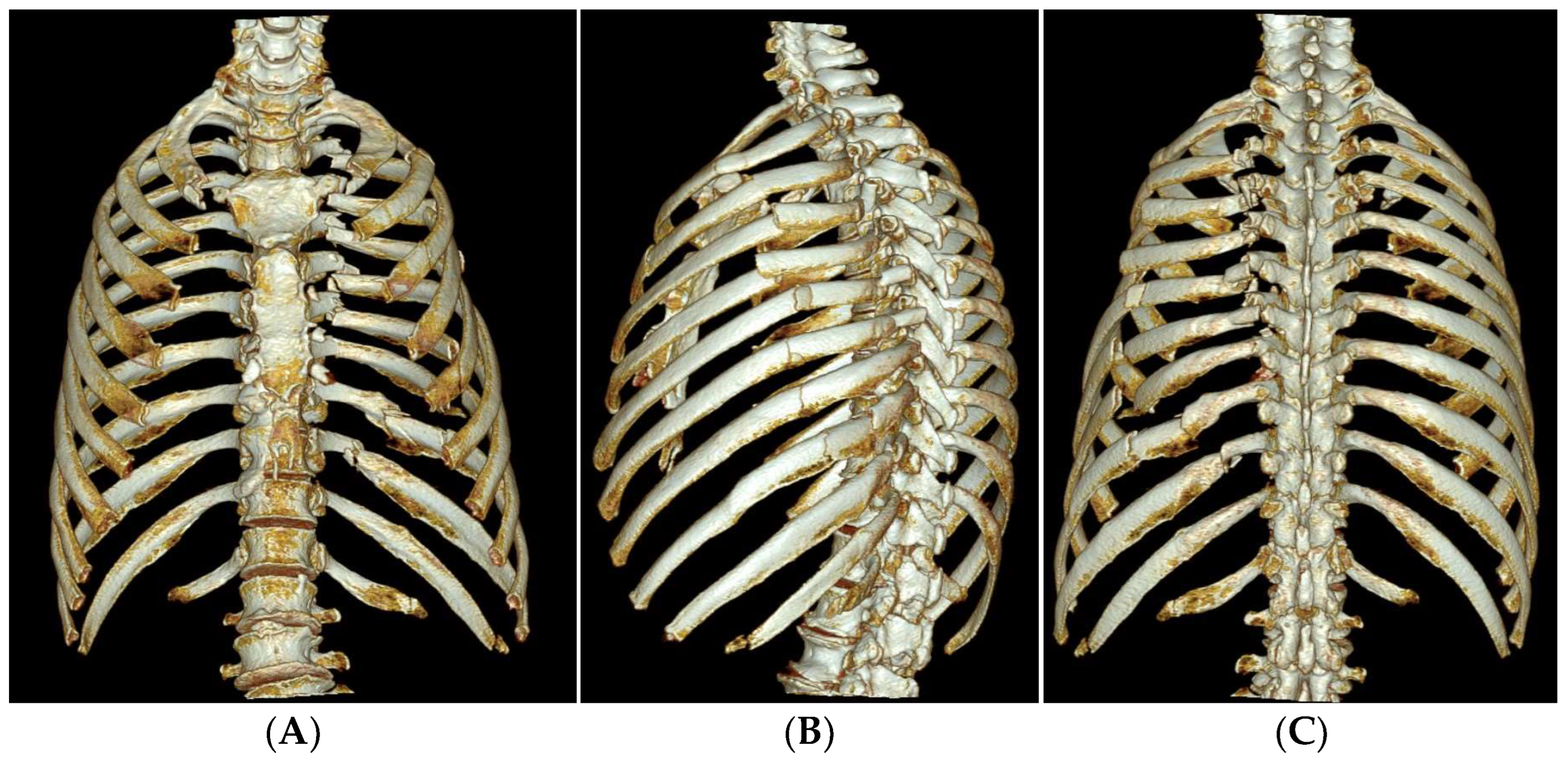 Medicina 60 02063 g002