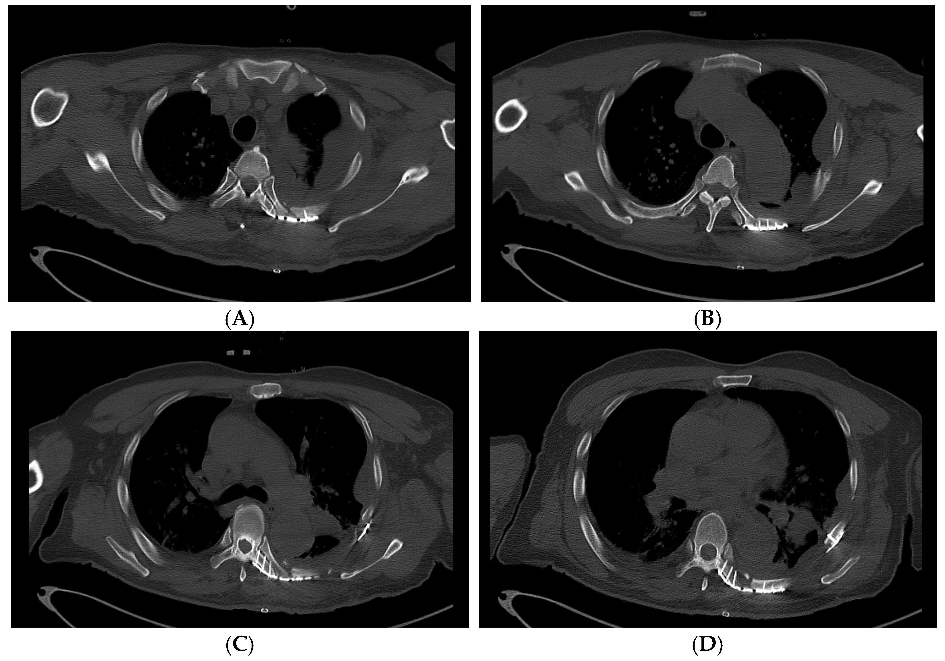 Medicina 60 02063 g004