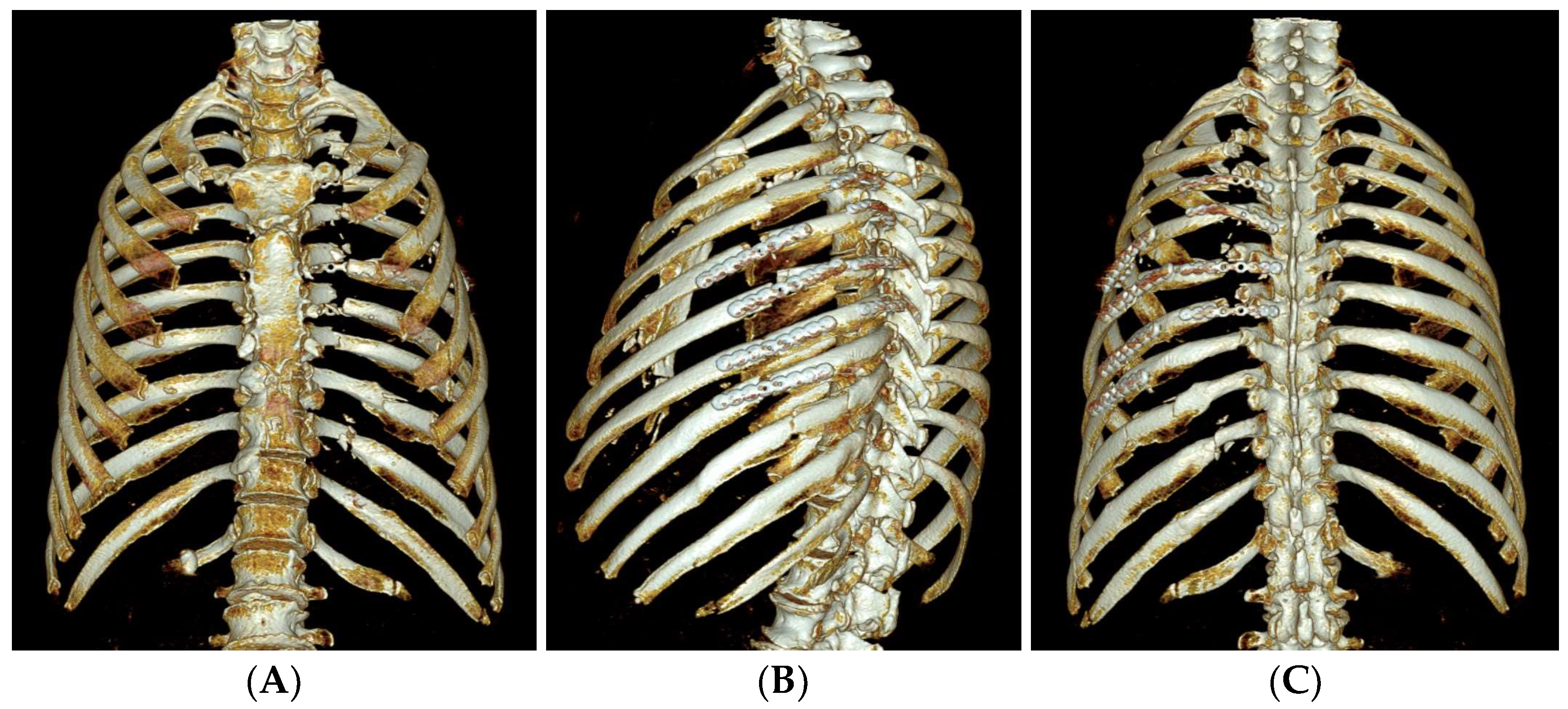 Medicina 60 02063 g005