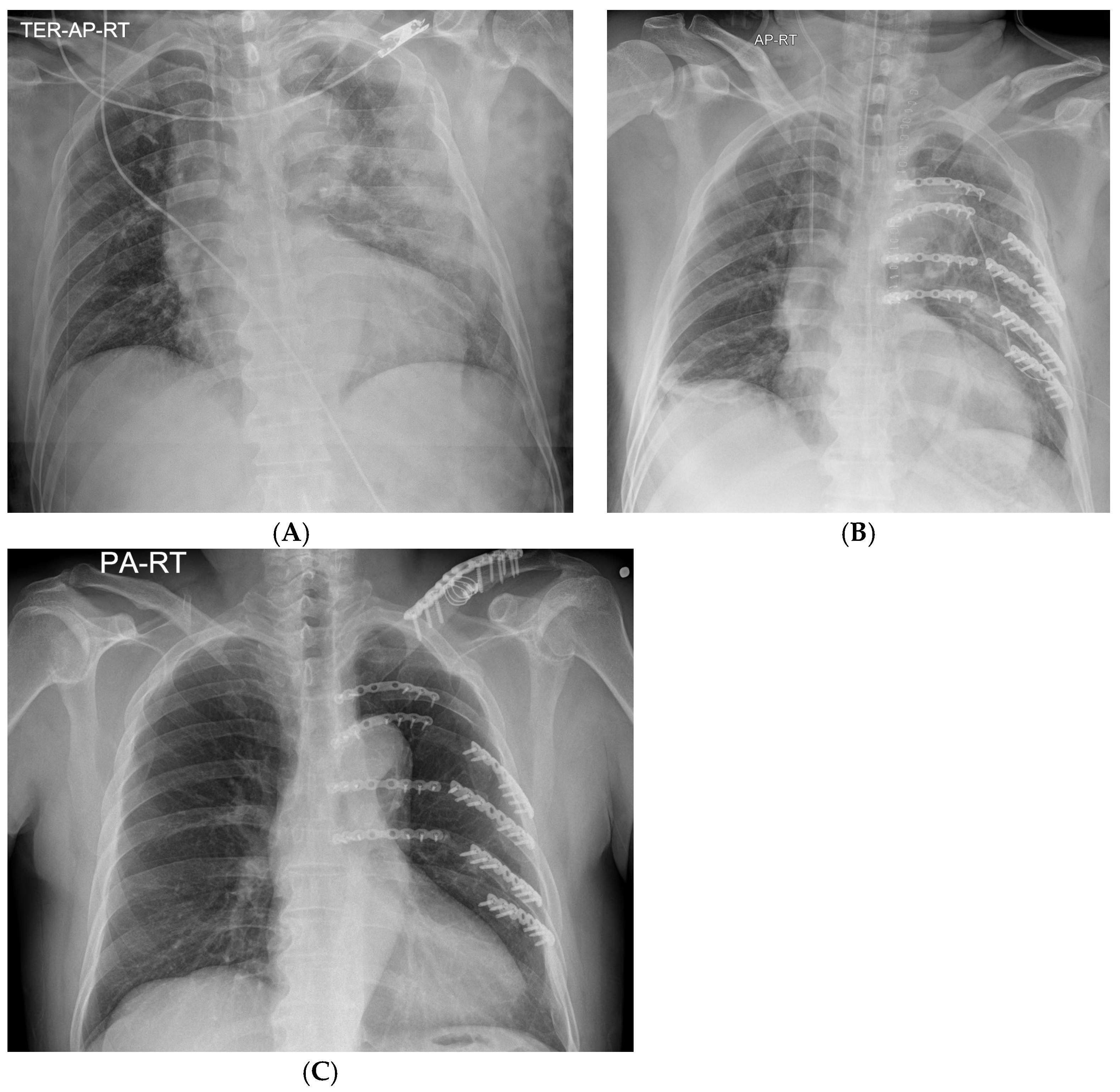 Medicina 60 02063 g006