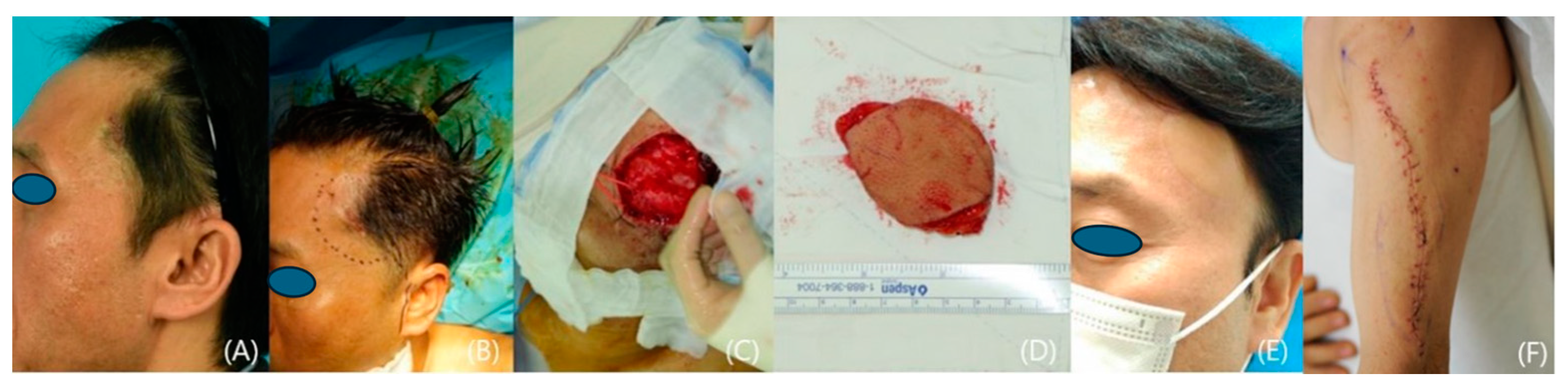 Medicina 60 02082 g003